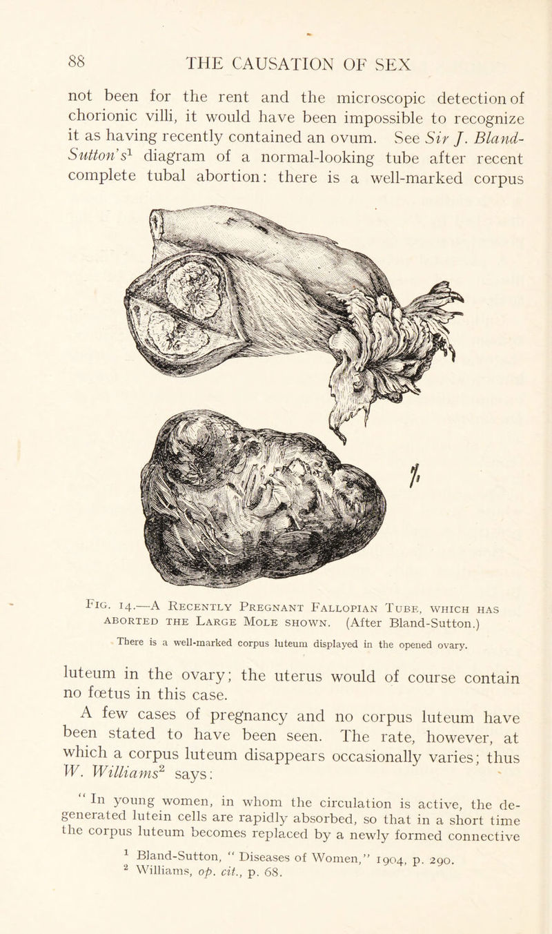 not been for the rent and the microscopic detection of chorionic villi, it would have been impossible to recognize it as having recently contained an ovum. See Sir J. Bland- Sutton's1 diagram of a normaldooking tube after recent complete tubal abortion: there is a well-marked corpus Fig. 14.—A Recently Pregnant Fallopian Tube, which has aborted the Large Mole shown. (After Bland-Sutton.) There is a well-marked corpus luteum displayed in the opened ovary. luteum in the ovary; the uterus would of course contain no foetus in this case. A few cases of pregnancy and no corpus luteum have been stated to have been seen. The rate, however, at which a corpus luteum disappears occasionally varies; thus W. Williams2 says: “In young women, in whom the circulation is active, the de- geneiated lutein cells are rapidly absorbed, so that in a short time the corpus luteum becomes replaced by a newly formed connective 1 Bland-Sutton, “ Diseases of Women, 1904, p. 290. 2 Williams, op. cit., p. 68.