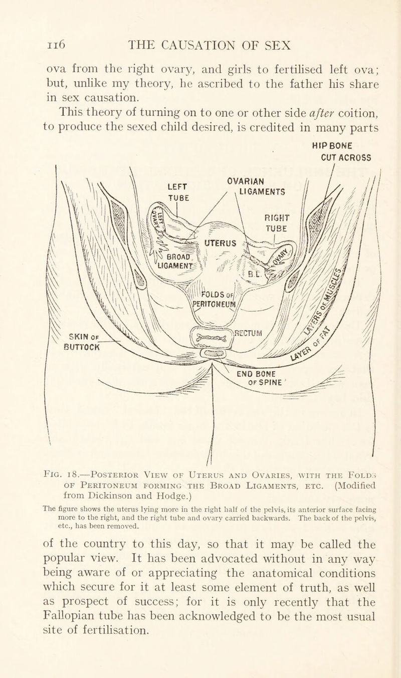 ova from the right ovary, and girls to fertilised left ova; but, unlike my theory, he ascribed to the father his share in sex causation. This theory of turning on to one or other side after coition, to produce the sexed child desired, is credited in many parts HIPBONE CUT ACROSS of Peritoneum forming the Broad Ligaments, etc. (Modified from Dickinson and Hodge.) The figure shows the uterus lying more in the right half of the pelvis, its anterior surface facing more to the right, and the right tube and ovary carried backwards. The back of the pelvis, etc., has been removed. of the country to this day, so that it may be called the popular view. It has been advocated without in any way being aware of or appreciating the anatomical conditions which secure for it at least some element of truth, as well as prospect of success; for it is only recently that the Fallopian tube has been acknowledged to be the most usual site of fertilisation.