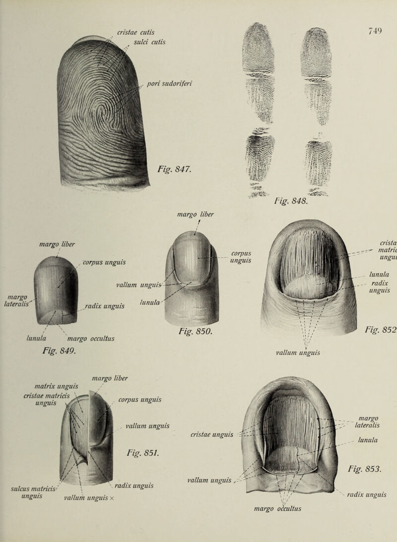 cristae cutis sulci cutis Fig. 848. margo über margo über margo lateralis'' , Corpus unguis radix unguis vallum lunula lunula margo occultus Fig. 850. Fig. 849. corpus unguis crista, matrii ungut lunula radix unguis vallum unguis Fig. 852 margo über matrix unguis vallum unguis cristae matricis unguis corpus unguis Fig. 851. sulcus matricis' \ ' ' radix unguis unguis vallum unguis x cristae unguis margo lateralis lunula vallum unguis \\p margo occultus Fig. 853. radix unguis