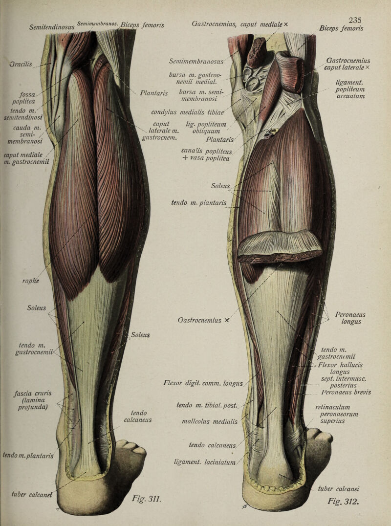 fascia cruris (lamina projunda) iendo m. plantaris Gastrocnemius x' Flexor digit. comm. longus tendo m. tibial. post, malleolus medialis tendo calcaneus ligament. laciniatum Peronaeus longus tendo m. mii Flexor hallucis longus sept. intermusc. posterius Peronaeus brevis retinaculum peronaeorum superius tuber calcanei Fig. 312. Gracilis fossa poplitca tendo rn.' cauda m. semi- membranosi caput mediale m. gastrocnen Scmimembranosus bursa m. gastroc- nemii medial. Plantaris bursa m. semi- membranosi condylus medialis caput lig. popliteum laterale m. obliquum gastrocnem. Plantaris canalis popliteus + vasa poplitea Gastrocnemius caput laterale x ligament. popliteum arcuatum Soleus tendo m. plantaris Fig. 311. raphe Soleus Soleus tendo calcaneus