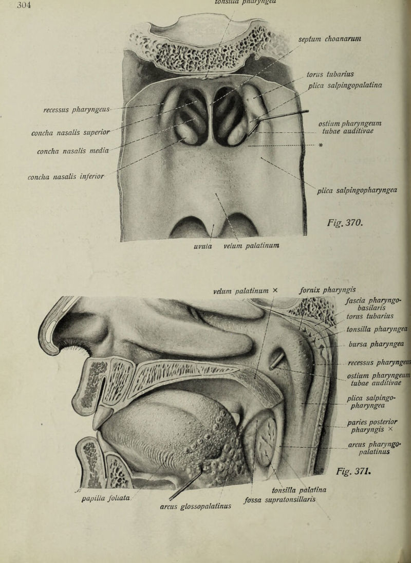 lonsiua pnuiyngtu torus tubarius plica salpingopalatina recessus pharyngeus concha nasalis superior concha nasalis media ostiarn pharyngeum tubae auditivae * concha nasalis inferior plica salpingopharyngea uvula velum palatinum Fig. 370. septum choanarum / papilia joliata velum palatinum x fornix pharyngis fascia pharyngo- basilaris torus tubarius tonsilla pharyngea bursa pharyngea recessus pharyngeus ostium pharyngeum tubae auditivae plica salpingo- pharyngea paries posterior pharyngis x arcus pharyngo- Palatinos Fig. 371. tonsilla palatina fossa supratonsillaris arcus glossopalatinus