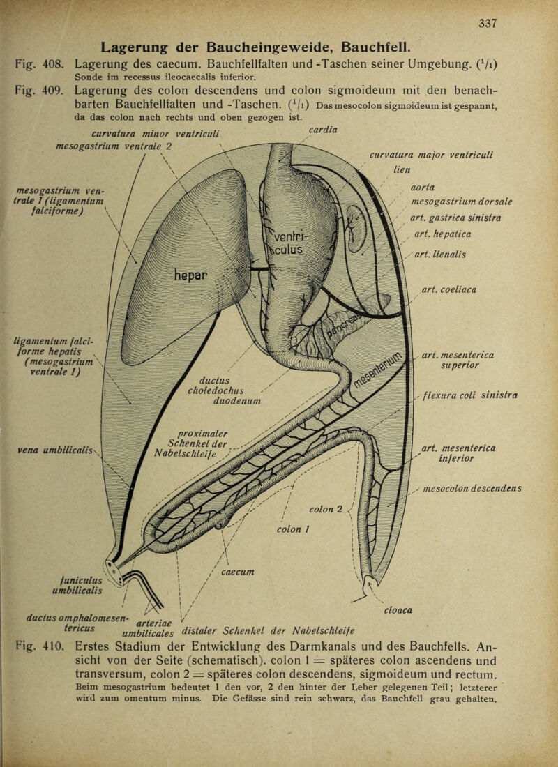 Lagerung der Baucheingeweide, Bauchfell. Fig. 408. Lagerung des caecum. Bauchfellfalten und-Taschen seiner Umgebung. (7i) Sonde im recessus ileocaecalis inferior. Fig. 409. Lagerung des colon descendens und colon sigmoideum mit den benach- barten Bauchfellfalten und -Taschen. (x/i) Das mesocolon sigmoideum ist gespannt, da das colon nach rechts und oben gezogen ist. cardia curvatura minor ventriculi mesogastrium ventrale 2 mesogastrium ven- trale 1 (ligamentuni falciforme) ligamentum falci- forme hepatis , (mesogastrium \| ventrale 1) vena umbilicalis funiculus umbilicalis curvatura major ventriculi lien aorta mesogastrium dorsale art. gastrica sinistra art. hepatica art. lienalis art. coeliaca , art. mesenterica superior flexura coli sinistra art. mesenterica inferior mesocolon descendens cloaca arteriae ductus omphalomesen- tericus umbilicales distaler Schenkel der Nabelschleife Fig. 410. Erstes Stadium der Entwicklung des Darmkanals und des Bauchfells. An- sicht von der Seite (schematisch), colon 1 = späteres colon ascendens und transversum, colon 2 = späteres colon descendens, sigmoideum und rectum. Beim mesogastrium bedeutet 1 den vor, 2 den hinter der Leber gelegenen Teil; letzterer wird zum omentum minus. Die Gefässe sind rein schwarz, das Bauchfell grau gehalten.