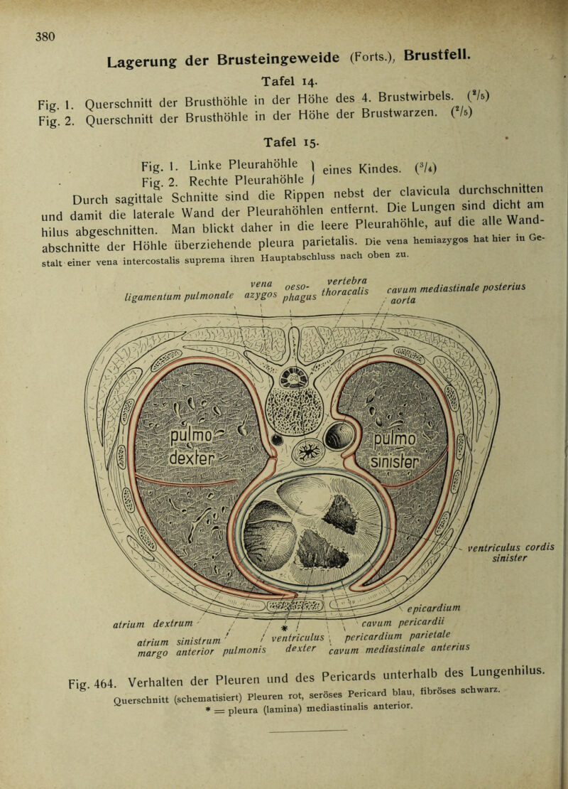 Lagerung der Brusteingeweide (Forts), Brustfell. Tafel 14. Fig 1 Querschnitt der Brusthöhle in der Höhe des 4. Brustwirbels (*/5) Fig. 2. Querschnitt der Brusthöhle in der Höhe der Brustwarzen. ( /.) Tafel 15. eines Kindes. (AU) Fig. 1. Linke Pleurahöhle ) Fig. 2. Rechte Pleurahöhle j ...... Durch sagittale Schnitte sind die Rippen nebst der clavicula durchschnitten und damit die laterale Wand der Pleurahöhlen entiernt. O.e Lengen sind d.cht am hilus abgeschnitten. Man blickt daher in die leere Pleurahohle, aul die alle Wa abschnitte der Höhle überziehende pleura parietalis. Die vena hemiaaygos hat hier m Ge- st.lt einer ven. intercostalis suprent. ihren Hanptabschluss nach oben au. vena oeso. vertebra ligamentum pulmonale azygos p/iagUs thoracalis , 1 cavum mediastinale posterius ' aorta ventriculus cordis sinister atrium dextrum epicardium _ ' cavum pericardii atrium sinisirum 7 / ventriculus \ 'pericardium ?arietale margo anterior pulmoms dexter cavum mediastinale anterius Fig 464. Verhalten der Pleuren und des Pericards unterhalb des Lungenhilus. Querschnitt (schematisier,) Pleuren rot, seröses Pericard blau, «ibröses schwere. * __ pleura (lamina) mediastinalis anterior.