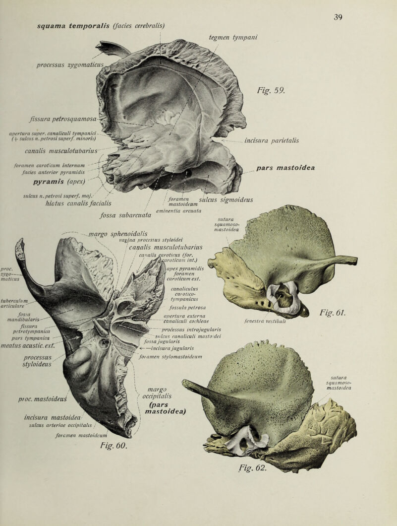 squama temporalis (fades cerebralis) processus fissura petrosquarnosa apertura super, canaliculi tympanici- (+- sulcas n.petrosisuperf. minoris) foramen caroticum iniernum facies anterior pyramidis su/cus n.petrosi superf. majr hiatus canalis facialis incisura parietalis pars mastoidea fossa subarcuata sigmoideus eminentia arcuata fissura pctrotympanica pars tympanica - meatus acustic. processus styloideus inargo sphenoidalis vagina processus styloidei ' canalis musculotubarius (for. int.) apex pyramidis foramen caroticum ext. canaliculus carotico- tympanicus fossula petrosa apertura externa canaliculi cochteae processus intrajugularis sulcus canaliculi masto:dei fossa jugularis —incisura jugularis foiamen styiomastoideum sutura sc/uamoso- mastoidea feneslra ptoc. mastoideui incisura mastoidea sulcus arteriae occipitahs ; foramen margo occipitalis (pars mastoidea) sutura squamoso- mastoidea tegmen tympani