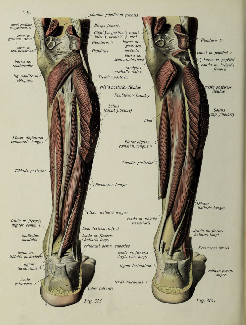 Flexor digitorum communis longus '• caput mediale m. gastrocn. X V\\ bursa m gastrocn. medial\ r cauda m. semimembranosi bursa m. \ semimembr. lig. popliteum obliquum ,planum popliteum femoris _Biceps femoris caput im. gastroc-\ caput - later \ nemii x j med. -Plantaris x Popliteus bursa m. gastrocn. medialis bursa m. sem im em branosi condylus medialis libiae Titialis posterior crista posterior fibulae Popliteus x (cauda) Soleus ■ ; (caput fibulare) tibia Flexor digitor. commun. longus X Tibialis posterior Tibialis posterior tendo m.flexoris digitor. comm. I. malleolus medialis \ kt» ff tendo m. ,,-W7 tibialis posterioHs \ J ligam. fW. ■ laciniatum \ ®»!| ffiP! tendo calcaneus x' Peronaeus longus -Flexor hallucis longus tendo m. tibialis posterioris tibia (extrem, infr.) tendo m.flexoris  hallucis long. retinacul. peron. superius tendo m.flexoris digit. com long. ligam. laciniatum tendo calcaneus x 'tuber calcanei Fig. 3/3 Plantaris x caput m. poplitei x bursa m. poplitei cauda m. bicipitis femoris posterior fibulae Soleus x pap. fibulare) hallucis longus m. flexor. hallucis longi Peronaeus brevis peron. super. Fig. 314.