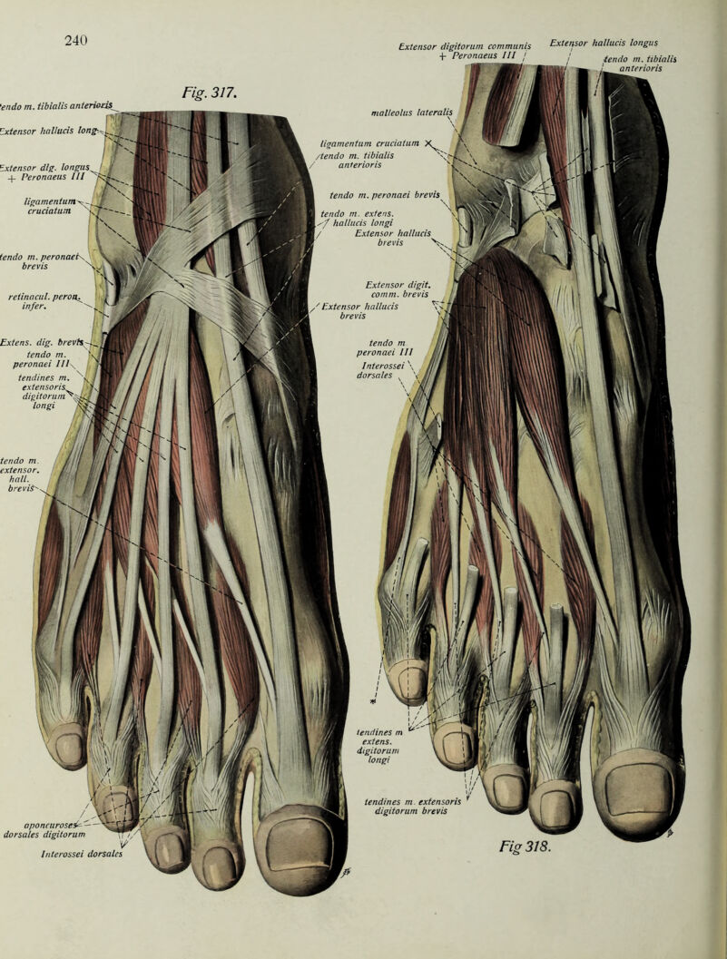 endo m. tibialis anterioris , : [l Zxtensor hnllucis long Ixtensor dig. longus -f Peronaeus III endo m. peronaei\ brevis retinacul. peron. infer. zxtens. dig. brevH-^^ tendo m. f peronaei I/l\ txtensor digitorum communis Extensor hallucis longus + Peronaeus III j / fendo m mialh anterioris Fig. 317. endo m. xtensor. uupm. hall. brevis aponcurosesP —— dorsales digitorum Int erossei dorsales