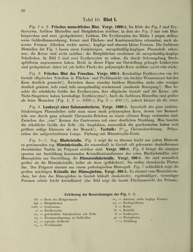 20 Tafel 10. Blut I. Fig. 1 u. 2. Frisches menschliches Blut. Vergr. 1000:1. Im Bilde der Fig. 1 sind Ery- throcyten, farblose Blutzellen und Blutplättchen sichtbar, in dem der Fig. 2 nur rote Blut- körperchen und zwei (grobgekörnte) farblose. Die Erythrocyten des Bildes 1 zeigen stellen- weise Geldrollenanordnung, ferner sind Flächen- und Kantenansichten erkennbar, auch ab- norme Formen (Glocken rechts unten), kuglige und abnorm kleine Formen. Die farblosen Blutzellen der Fig. 1 lassen einen feinkörnigen, unregelmäßig-kugligen Plasmaleib erken- nen; die Kerne sind nicht sichtbar; die Blutplättchen erscheinen als unregelmäßig-kuglige Scheibchen. In Bild 2 sind zwei Erythrocyten zu sehen, die durch Schrumpfung Stech- apfelform angenommen haben. Beide in dieser Figur zur Darstellung gelangte Leukocyten sind grobgekörnt; daher ist (als heller Fleck) der polymorphe Kern sichtbar (nicht sehr stark). Fig. 3. Frisches Blut des Frosches. Vergr. 400:1. Kernhaltige Erythrocyten von der Gestalt elliptischer Scheiben in Flächen- und Profilansicht (ein leichter Wasserzusatz hat den Kern deutlich gemacht!). Zwischen ihnen einzelne farblose Blutzellen, mehr oder weniger deutlich gekörnt, teils rund, teils unregelmäßig erscheinend (amöboide Bewegung!). Man be- achte die erhebliche Größe der Erythrocyten, ihre elliptische Gestalt und die Kerne (alle Nicht-Säugetiere haben kernhaltige Erythrocyten!). Auch die farblosen Blutzellen sind größer als beim Menschen (Fig. 1,2= 1000 X, Fig. 3 — 400x1), jedoch kleiner als die roten. Fig. 4. Leukocyt einer Salamanderlarve. Vergr. 1000:1. Innerhalb des ganz nackten, feinkörnigen Plasmaleibes sieht man einen stark polymorphen Kern, dessen vier Bestand- teile nur durch ganz schmale Chromatin-Brücken zu einem offenen Ringe verbunden sind. Zwischen den „vier“ Kernen das Centrosoma mit einer deutlichen Strahlung. Man beachte die erhebliche Größe der Zelle (die Amphibien, namentlich die geschwänzten haben weit größere zellige Elemente als der Mensch!). Technik: 2%o Chromsäurelösung. Präpa- ration der aufgeschnittenen Lunge. Färbung mit Hämatoxylin-Eosin. Fig. 5—7. Sog. Blutkristalle. Fig. 5 zeigt die so überaus leicht aus jedem Blutreste zu gewinnenden sog. Häminkristalle, die massenhaft in Gestalt oft gekreuzter dunkelbrauner rhombischer Nadeln im Präparat sichtbar sind. Vergr. 800:1. Fig. 6 bringt die einzigen spontan zur Ausbildung kommenden Kristallisationsformen des roten Blutfarbstoffes oder Hämoglobin zur Darstellung, die Hämatoidinkristalle. Vergr. 500:1. Sie sind wesentlich größer als die Häminkristalle, heller als diese (gelblichrot). Sie stellen rhombische Platten dar. Das Präparat stammt aus einem pathologischen Bluterguß. Fig. 7 schließlich zeigt die großen mächtigen Kristalle des Hämoglobins. Vergr. 300:1. Es stammt vom Meerschwein- chen, bei dem das Hämoglobin in Gestalt lebhaft dunkelroter, regelmäßiger, vierseitiger Prismen relativ leicht kristallisiert (das Bild zeigt die basale Flächenansicht des Prisma). Erklärung der Bezeichnungen der Fig. 1—7. blr = Reste des Blutgerinnsels bpi = Blutplättchen centr = Centrosoma er = Erythrocyten eri = gewöhnliche Scheibenform mit Delle er„ = Zusammenlagerung zu Geldrollen er» = typische Geldrolle eri = Profilansicht er5 = abnorme, mehr kuglige Formen er7 = Stechapfelform k = Kerne kr = Kristalle Ic = Leukocyten pr = Protoplasma r = Strahlung