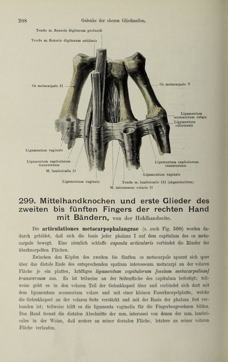 Tendo m. flexoris digitorum profundi Tendo m. flexoris digitoruin sublimis ] Os metacarpale II — Ligamentum vaginale Ligamentum capitulorum transversum M. lumbricalis II Ligamentum vaginale Os metacarpale V Ligamentum accessorium volare Ligamentum capitulorum transversum Ligamentum vaginale j! Tendo m. lumbricalis III (abgescbnitten) M. interosseus volaris II 299. Mittelhandknochen und erste Glieder des zweiten bis fünften Fingers der rechten Hand mit Bändern, von der Hohlhandseite. Die articulationes metacarpoplialangeae (s. auch Fig. 300) werden da- durch gebildet, daß sich die basis jeder phalanx I auf dem capitulum des os meta- carpale bewegt. Eine ziemlich schlaffe capsula articülaris verbindet die Künder der überknorpelten Flächen. Zwischen den Köpfen des zweiten bis fünften os metacarpale spannt sich quer über das distale Ende des entsprechenden spatium interosseum metacarpi an der volaren Fläche je ein plattes, kräftiges ligamentum capitulorum [ossium metacarpalium] transversum aus. Es ist teilweise an der Seitenfläche des capitulum befestigt; teil- weise geht es in den volaren Teil der Gelenkkapsel über und verbindet sich dort mit dem ligamentum accessorium volare und mit einer kleinen Faserknorpelplatte, welche die Gelenkkapsel an der volaren Seite verstärkt und mit der Basis der phalanx fest ver- bunden ist; teilweise hilft es die ligamenta vaginalia für die Fingerbeugesehnen bilden. Das Band trennt die distalen Abschnitte der mm. interossei von denen der mm. lumbri- cales in der Weise, daß erstere an seiner dorsalen Fläche, letztere an seiner volaren Fläche verlaufen.