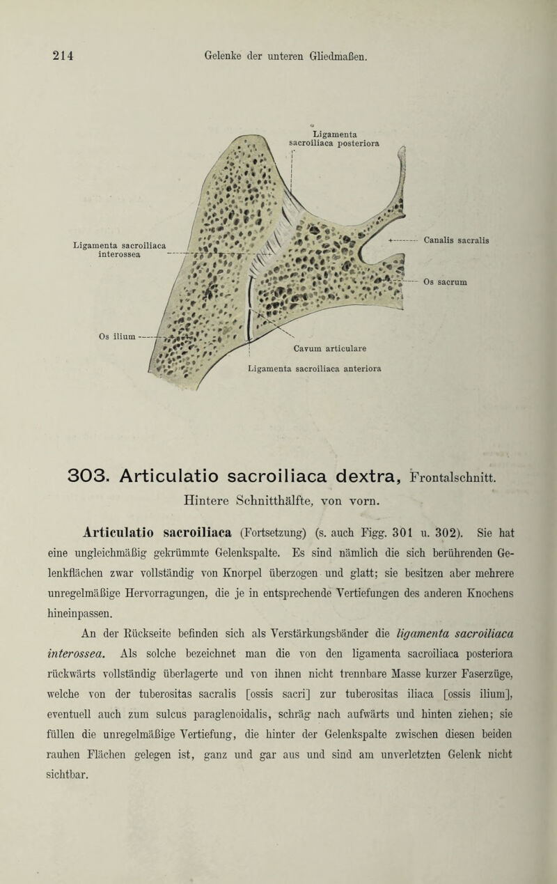303. Articulatio sacroiliaca dextra, Frontalschnitt. Hintere Schnitthälfte, von vorn. Articulatio sacroiliaca (Fortsetzung) (s. auch Figg. 301 u. 302). Sie hat eine ungleichmäßig gekrümmte Gelenkspalte. Es sind nämlich die sich berührenden Ge- lenkflächen zwar vollständig von Knorpel überzogen und glatt; sie besitzen aber mehrere unregelmäßige Hervorragungen, die je in entsprechende Vertiefungen des anderen Knochens hineinpassen. An der Rückseite befinden sich als Verstärkungsbänder die ligamenta sacroiliaca interossea. Als solche bezeichnet man die von den ligamenta sacroiliaca posteriora rückwärts vollständig überlagerte und von ihnen nicht trennbare Masse kurzer Faserzüge, welche von der tuberositas sacralis [ossis sacri] zur tuberositas iliaca [ossis ilium], eventuell auch zum sulcus paraglenoidalis, schräg nach aufwärts und hinten ziehen; sie füllen die unregelmäßige Vertiefung, die hinter der Gelenkspalte zwischen diesen beiden rauhen Flächen gelegen ist, ganz und gar aus und sind am unverletzten Gelenk nicht sichtbar.