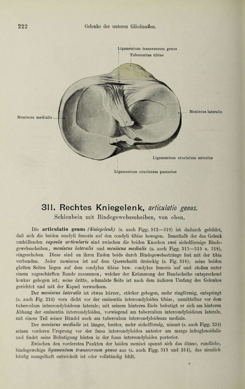 Ligamentum transversum genus Tuberositas tibiae Meniscus medialis . 311. Rechtes Kniegelenk, articulatio genus. Schienbein mit Bindegewebsscheiben, von oben. Die articulatio genus (Kniegelenk) (s. auch Figg. 312—319) ist dadurch gebildet, daß sich die beiden condyli femoris auf den condyli tibiae bewegen. Innerhalb der das Gelenk umhüllenden capsula articularis sind zwischen die beiden Knochen zwei sichelförmige Binde- gewebsscheiben, meniscus lateralis und meniscus medialis (s. auch Figg. 313—315 u. 318), eingescboben. Diese sind an ihren Enden beide durch Bindegewebsstränge fest mit der tibia verbunden. Jeder meniscus ist auf dem Querschnitt dreieckig (s. Fig. 318); seine beiden glatten Seiten liegen auf dem condylus tibiae bzw. condylus femoris auf und stoßen unter einem zugeschärften Rande zusammen, welcher der Krümmung der Bandscheibe entsprechend konkav gebogen ist; seine dritte, schmälste Seite ist nach dem äußeren Umfang des Gelenkes gerichtet und mit der Kapsel verwachsen. Der meniscus lateralis ist etwas kürzer, stärker gebogen, mehr ringförmig, entspringt (s. auch Fig. 224) vorn dicht vor der eminentia intercondyloidea tibiae, unmittelbar vor dem tubercidum intercondyloideum laterale; mit seinem hinteren Ende befestigt er sich am hinteren Abhang der eminentia intercondyloidea, vorwiegend am tuberculum intercondyloideum laterale, mit einem Teil seiner Bündel auch am tuberculum intercondyloideum mediale. Der meniscus medialis ist länger, breiter, mehr sichelförmig, nimmt (s. auch Figg. 224) seinen vorderen Ursprung vor der fossa intercondyloidea anterior am margo infraglenoidalis und findet seine Befestigung hinten in der fossa intercondyloidea posterior. Zwischen den vordersten Punkten der beiden menisci spannt sich das dünne, rundliche, bindegewebige ligamentum transversum genus aus (s. auch Figg. 313 und 314), das ziemlich häufig mangelhaft entwickelt ist oder vollständig fehlt.