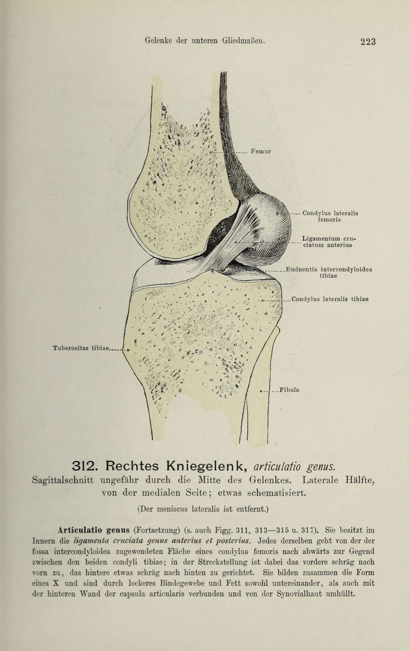 Tuberositas tibiae ... Femur — Condylus lateralis femoris Ligamentum cru- ciatum anterius Eminentia intereondyloidea tibiae Condylus lateralis tibiae ...Fibula 312. Rechtes Kniegelenk, articulatio genus. Sagittalschnitt ungefähr durch die Mitte des Gelenkes. Laterale Hälfte, von der medialen Seite; etwas schematisiert. (Der meniscus lateralis ist entfernt.) Articulatio genus (Fortsetzung) (s. aucli Figg. 311, 313—315 u. 317). Sie besitzt im Innern die Ligamenta cruciata genus anterius et posterius. Jedes derselben gebt von der der fossa intereondyloidea zugewendeten Fläche eines condylus femoris nach abwärts zur Gegend zwischen den beiden condyli tibiae; in der Strecksteilung ist dabei das vordere schräg nach vorn zu, das hintere etwas schräg nach hinten zu gerichtet. Sie bilden zusammen die Form eines X und sind durch lockeres Bindegewebe und Fett sowohl untereinander, als auch mit der hinteren Wand der capsula articularis verbunden und von der Synovialhaut umhüllt.