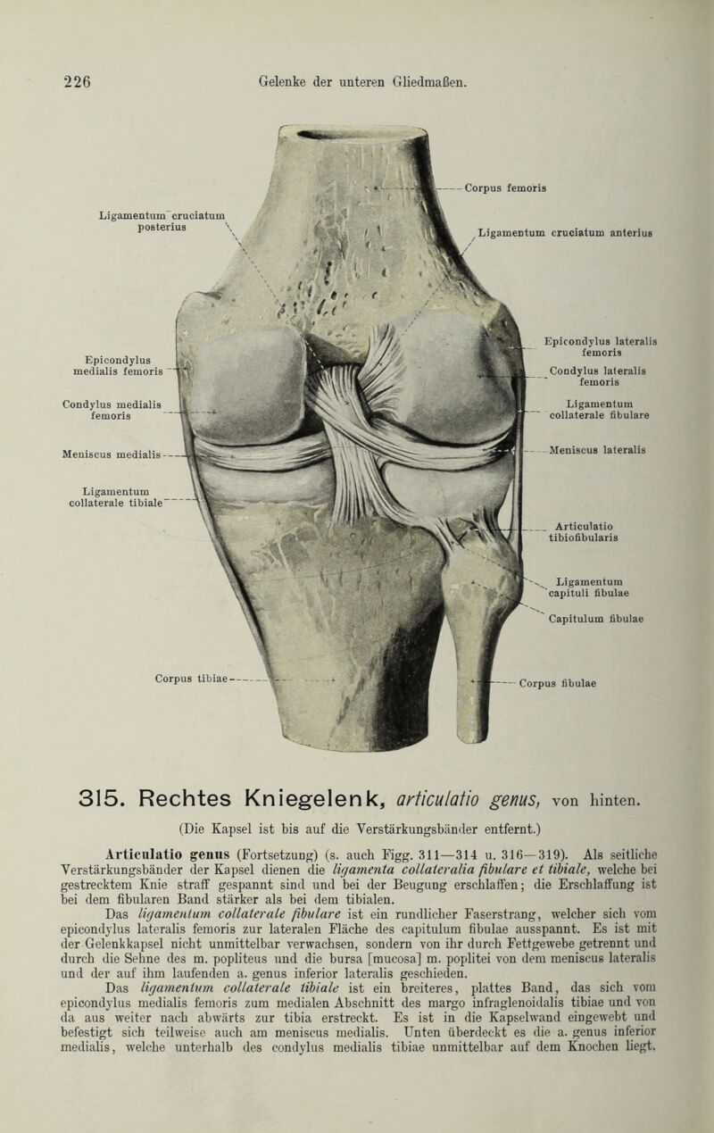 Ligamentum crueiatum posterius - Corpus femoris Ligamentum crueiatum anterius Epieondylus medialis femoris Condylus medialis femoris Meniscus medialis - Epieondylus lateralis femoris Condylus lateralis femoris Ligamentum collaterale fibulare Meniscus lateralis Artieulatio tibiofibularis Ligamentum capituli fibulae Capitulum fibulae Corpus tibiae Corpus fibulae Ligamentum collaterale tibiale- 315. Rechtes Kniegelenk, artieulatio genus, von hinten. (Die Kapsel ist bis auf die Verstärkungsbänder entfernt.) Artieulatio genus (Fortsetzung) (s. auch Figg. 311—314 u. 316—319). Als seitliche Verstärkungsbänder der Kapsel dienen die ligarnenta collateralia fbulare et tibiale, welche bei gestrecktem Knie straff gespannt sind und bei der Beugung erschlaffen; die Erschlaffung ist bei dem fibularen Band stärker als bei dem tibialen. Das ligamenlum collaterale ßbulare ist ein rundlicher Faserstrang, welcher sich vom epieondylus lateralis femoris zur lateralen Fläche des capitulum fibulae ausspannt. Es ist mit der Gelenkkapsel nicht unmittelbar verwachsen, sondern von ihr durch Fettgewebe getrennt und durch die Sehne des m. popliteus und die bursa [mucosa] m. poplitei von dem meniscus lateralis und der auf ihm laufenden a. genus inferior lateralis geschieden. Das ligamenlum collaterale tibiale ist ein breiteres, plattes Band, das sich vom epieondylus medialis femoris zum medialen Abschnitt des margo infraglenoidalis tibiae und von da aus weiter nach abwärts zur tibia erstreckt. Es ist in die Kapselwand eingewebt und befestigt sich teilweise auch am meniscus medialis. Unten überdeckt es die a. genus inferior medialis, welche unterhalb des condylus medialis tibiae unmittelbar auf dem Knochen liegt.