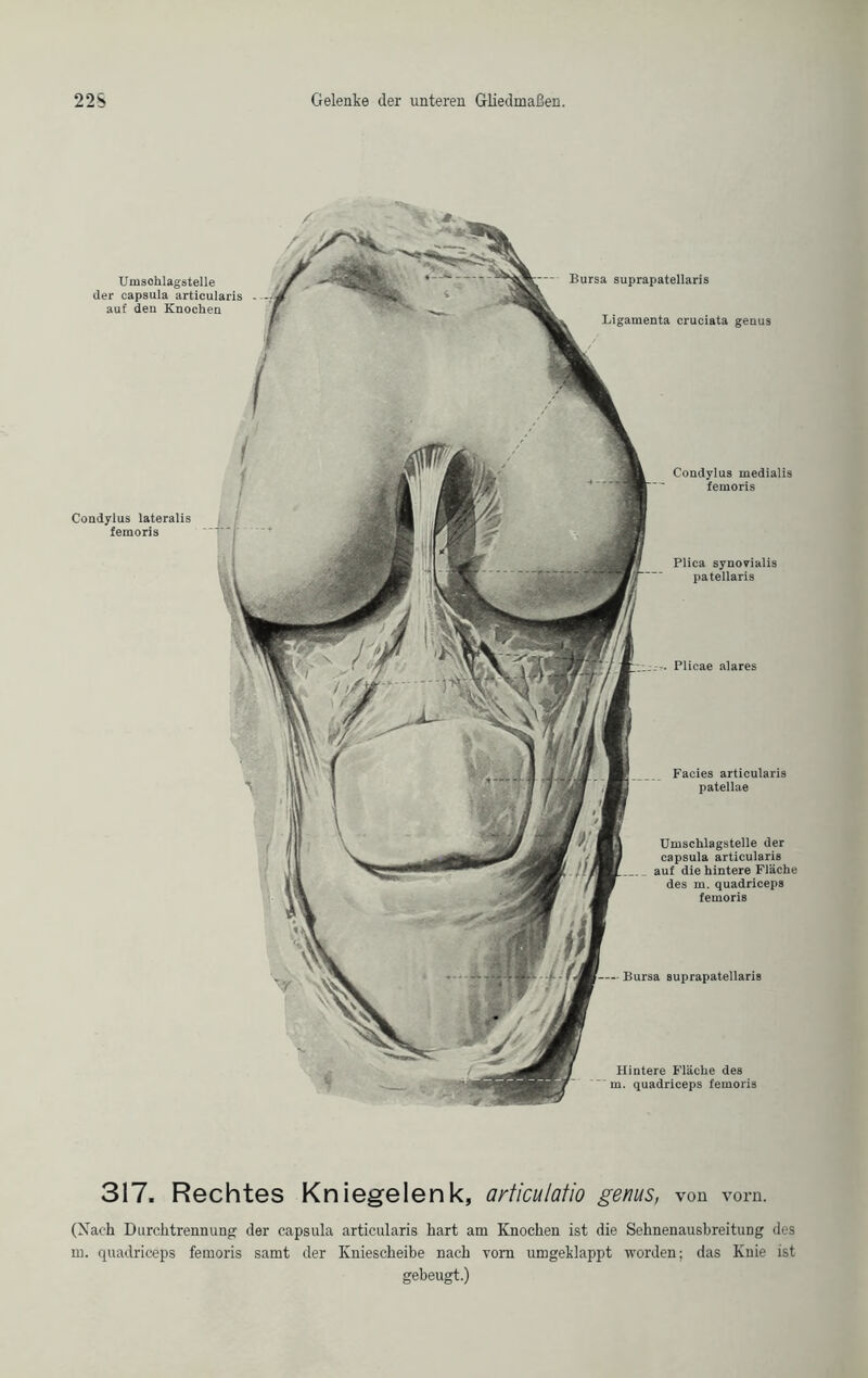 Plicae alares Facies articularis patellae Umschlagstelle der capsula articularis aut die hintere Fläche des in. quadriceps femoris Bursa suprapatellaris Bursa suprapatellaris Ligamenta cruciata genus Hintere Fläche des m. quadriceps femoris Umsohlagstelle der capsula articularis auf den Knochen Condylus medialis femoris Condylus lateralis femoris Plica synovialis patellaris 317. Rechtes Kniegelenk, articulatio genus, von vorn. (Xach Durchtrennung der capsula articularis hart am Knochen ist die Sehnenausbreitung des in. quadriceps femoris samt der Kniescheibe nach vom umgeklappt worden; das Knie ist gebeugt.)