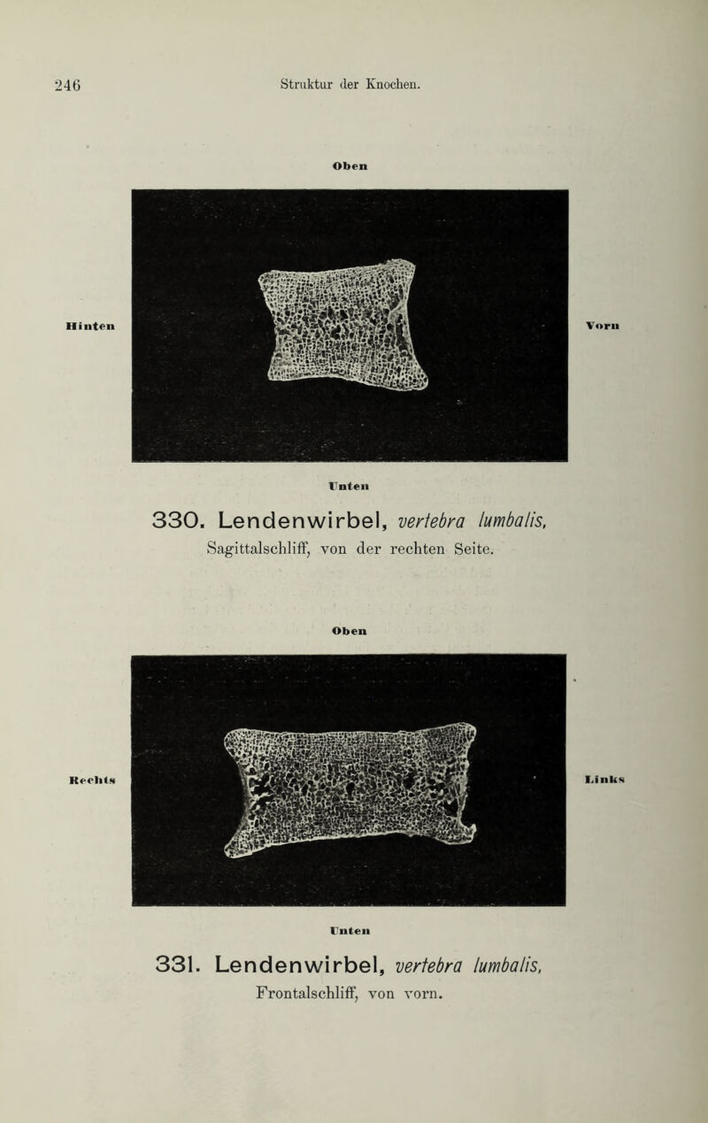 Oben Unten 330. Lendenwirbel, veriebra lumbalis, Sagittalschliff, von der rechten Seite. Oben Unten 331. Lendenwirbel, vertebra lumbalis,