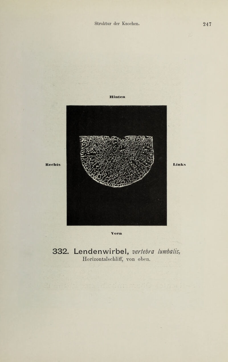 Hinten 332. Lendenwirbel, vertebra lumbalis,