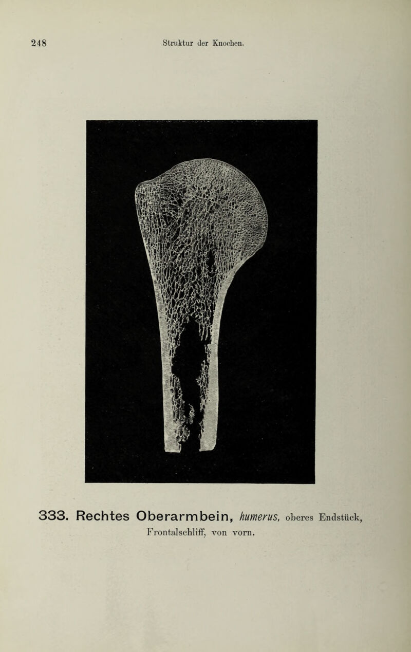 333. Rechtes Oberarmbein, humerus, oberes Endstück,