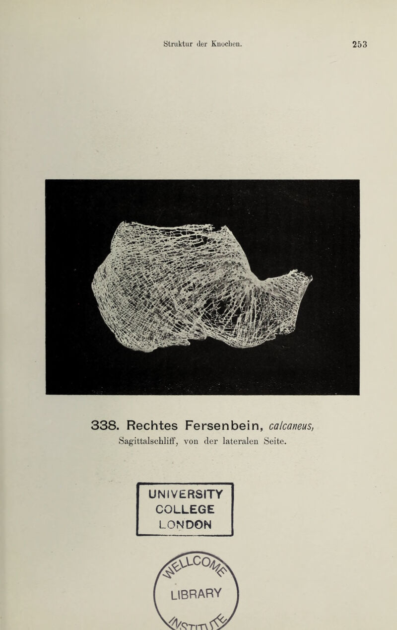 338. Rechtes Fersenbein, calcaneus, Sagittalschliff, von der lateralen Seite. UNIVERSITY COLLEGE LONDON UBRARY