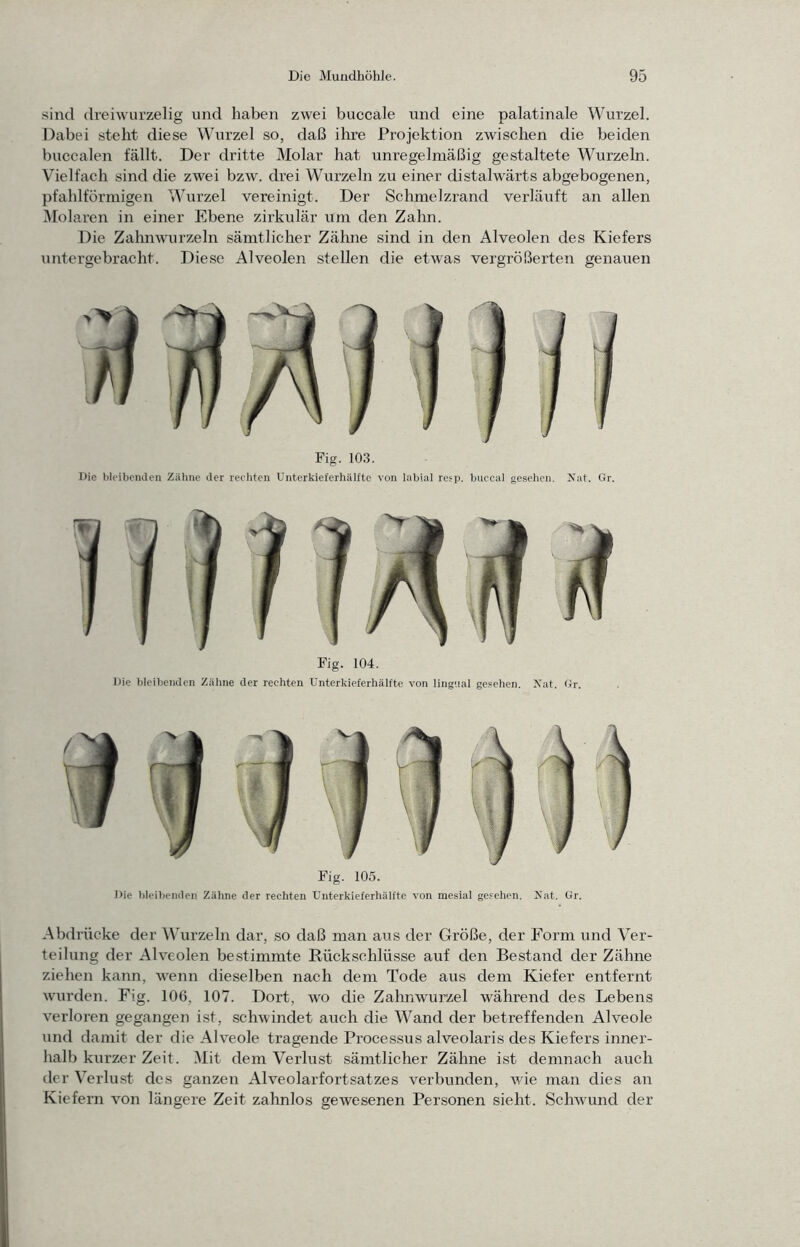 sind (Ireiwurzelig und haben zwei buccale und eine palatinale Wurzel. Dabei steht diese Wurzel so, daß ihi’e Projektion zwischen die beiden buccalen fällt. Der dritte Molar hat unregelmäßig gestaltete Wurzeln. Vielfach sind die zwei bzw. drei Wurzeln zu einer distalwärts abgebogenen, pfahlförmigen Wurzel vereinigt. Der Schmelzrand verläuft an allen Molaren in einer Ebene zirkulär um den Zahn. Die Zahnwmrzeln sämtlicher Zälme sind in den Alveolen des Kiefers untergebracht. Diese Alveolen stellen die etwas vergrößerten genauen Fig. 103. Die bleibenden Zahne der rechten Unterkieferhälfte von labial retp. buccal gesehen. Nat. Gr. Die bleibenden Zähne der rechten Unterkieferhälfte von lingual gesehen. Xat. Gr. Fig. 105. Die bleibenden Zähne der rechten Unterkieferhälfte von mesial ge.'^ehen. Jvat. Gr. Abdrücke der Wurzeln dar, so daß man aus der Größe, der Form und Ver- teilung der Alveolen bestimmte Rückschlüsse auf den Bestand der Zähne ziehen kann, wenn dieselben nach dem Tode aus dem Kiefer entfernt wurden. Fig. 106, 107. Dort, wo die Zahnwurzel während des Lebens verloren gegangen ist, schwindet auch die Wand der betreffenden Alveole und damit der die Alveole tragende Processus alveolaris des Kiefers inner- halb kurzer Zeit. Mit dem Verlust sämtlicher Zähne ist demnach auch der Verlust des ganzen Alveolarfortsatzes verbunden, wie man dies an Kiefern von längere Zeit zahnlos gewesenen Personen sieht. Schwund der