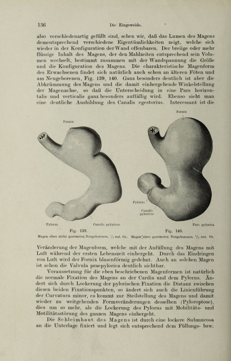 also verschiedenartig gefüllt sind, sehen wir, daß das Lumen des Magens dementsprechend verschiedene Eigentümliclikeiten zeigt, welche sich wieder in der Konfiguration der Wand offenbaren. Der breiige oder mehr flüssige Inhalt des Magens, der den Mahlzeiten entsprechend sein Volu- men wechselt, bestimmt zusammen mit der Wandspannung die Größe und die Konfiguration des Magens. Die charakteristische Magenform des Erwachsenen findet sich natürlich auch schon an älteren Föten und am Neugeborenen, Fig. 139, 140. Ganz besonders deutlich ist aber die Abkrümmung des Magens und die damit einhergehende Winkelstellung der Magenachse, so daß die Unterscheidung in eine Pars horizon- talis und verticalis ganz besonders auffällig wird. Ebenso sieht man eine deutliche Ausbildung des Canalis egestorius. Interessant ist die Fornix Fig. 139. Magen eines nicht geatmeten Neugeborenen, y, nat. Gr. Fornix Pars pylorica Fig. 140. Magen'eines geatmeten Neugeborenen. Vs nat. Gr. Veränderung der Magenform, welche mit der Anfüllung des Magens mit Luft während der ersten Lebenszeit einhergeht. Durch das Eindringen von Luft wird der Fornix blasenförmig gedehnt. Auch an solchen Magen ist schon die Valvula praepylorica deutlich sichtbar. Voraussetzung für die eben bescluiebenen Magenformen ist natürlich die normale Fixation des Magens an der Cardia und dem Pylorus. Än- dert sich durch Lockerung der pylorischen Fixation die Distanz zwischen diesen beiden Fixationspunkten, so ändert sich auch die Linienführung der Curvatura minor, es kommt zur Steilstellung des Magens und damit wieder zu weitgehenden Form Veränderungen desselben (Pyloroptose), dies um so mehr, als die Lockerung des Pylorus mit Mobilitäts- und Motilitätsstörung des ganzen Magens einhergeht. Die Schleimhaut des Magens ist durch eine lockere Submucosa an die Unterlage fixiert und legt sich entsprechend dem Füllungs- bzw.