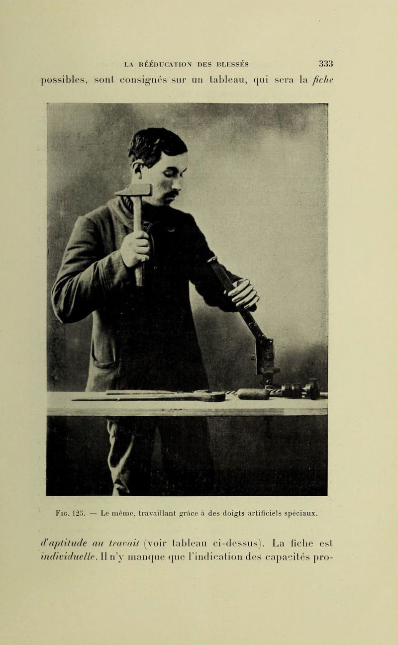 possibles, sont consignés sur un tableau, qui sera la fiche Fig. 123. — Le même, travaillant grâce à des doigts artificiels spéciaux. d'aptitude au travail (voir tableau ci-dessus). La fiche est individuelle. 11 n’y manque que l'indication des capacités pro-