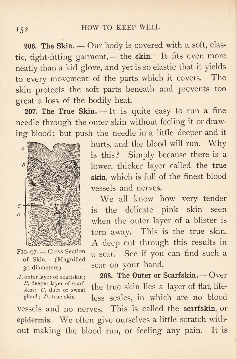 iS^ 206. The Skin. — Our body is covered with a soft, elas- tic, tight-fitting garment,—the skin. It fits even more neatly than a kid glove, and yet is so elastic that it yields to every movement of the parts which it covers. The skin protects the soft parts beneath and prevents too great a loss of the bodily heat. 207. The True Skin. — It is quite easy to run a fine needle through the outer skin without feeling it or draw- ing blood; but push the needle in a little deeper and it hurts, and the blood will run. Why is this? Simply because there is a lower, thicker layer called the true skin, which is full of the finest blood vessels and nerves. We all know how very tender is the delicate pink skin seen when the outer layer of a blister is torn away. This is the true skin. A deep cut through this results in a scar. See if you can find such a scar on your hand. 208. The Outer or Scarfskin. — Over the true skin lies a layer of flat, life- less scales, in which are no blood vessels and no nerves. This is called the scarfskin, or epidermis. We often give ourselves a little scratch with- out making the blood run, or feeling any pain. It is 30 diameters) A, outer layer of scarfskin; B, deeper layer of scarf- skin; C, duct of sweat gland; Z>, true skin