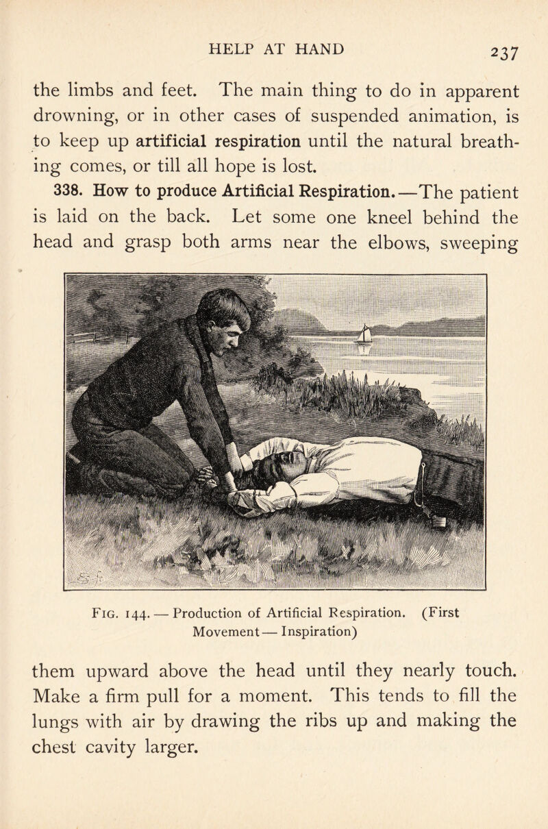 the limbs and feet. The main thing to do in apparent drowning, or in other cases of suspended animation, is to keep up artificial respiration until the natural breath- ing comes, or till all hope is lost. 338. How to produce Artificial Respiration.-—-The patient is laid on the back. Let some one kneel behind the head and grasp both arms near the elbows, sweeping Fig. 144. — Production of Artificial Respiration. (First Movement— Inspiration) them upward above the head until they nearly touch. Make a firm pull for a moment. This tends to fill the lungs with air by drawing the ribs up and making the chest cavity larger.