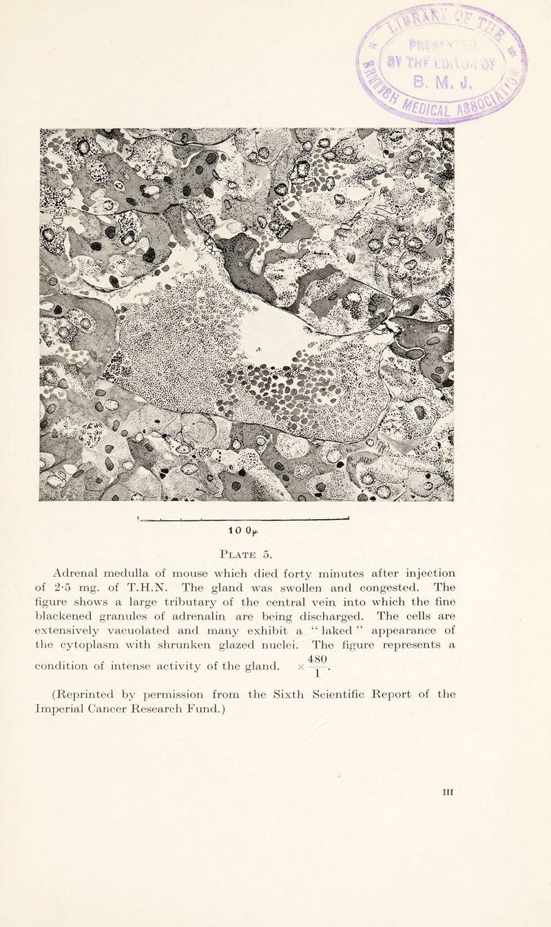A 10 Op. Plate 5. Adrenal medulla of mouse which died forty minutes after injection of 2-5 mg. of T.H.lSr. The gland was swollen and congested. The figure shows a large tributary of the central vein into which the fine blackened granules of adrenalin are being discharged. The cells are extensively vacuolated and many exhibit a the cytoplasm with shrunken glazed nuclei. condition of intense activity of the gland. x (Reprinted by permission from the Sixth Imperial Cancer Research Fund.) “ laked ” appearance of The figure represents a 480 1 ' Scientific Report of the