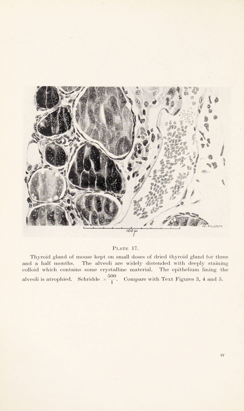 Thyroid gland of mouse kept on small doses of dried thyroid gland for three and a half months. The alveoli are widely distended with deeply staining colloid which contains some crystalline material. The epithelium lining the alveoli is atrophied. Schridde x —~-. Compare with Text Figures 3, 4 and 5.