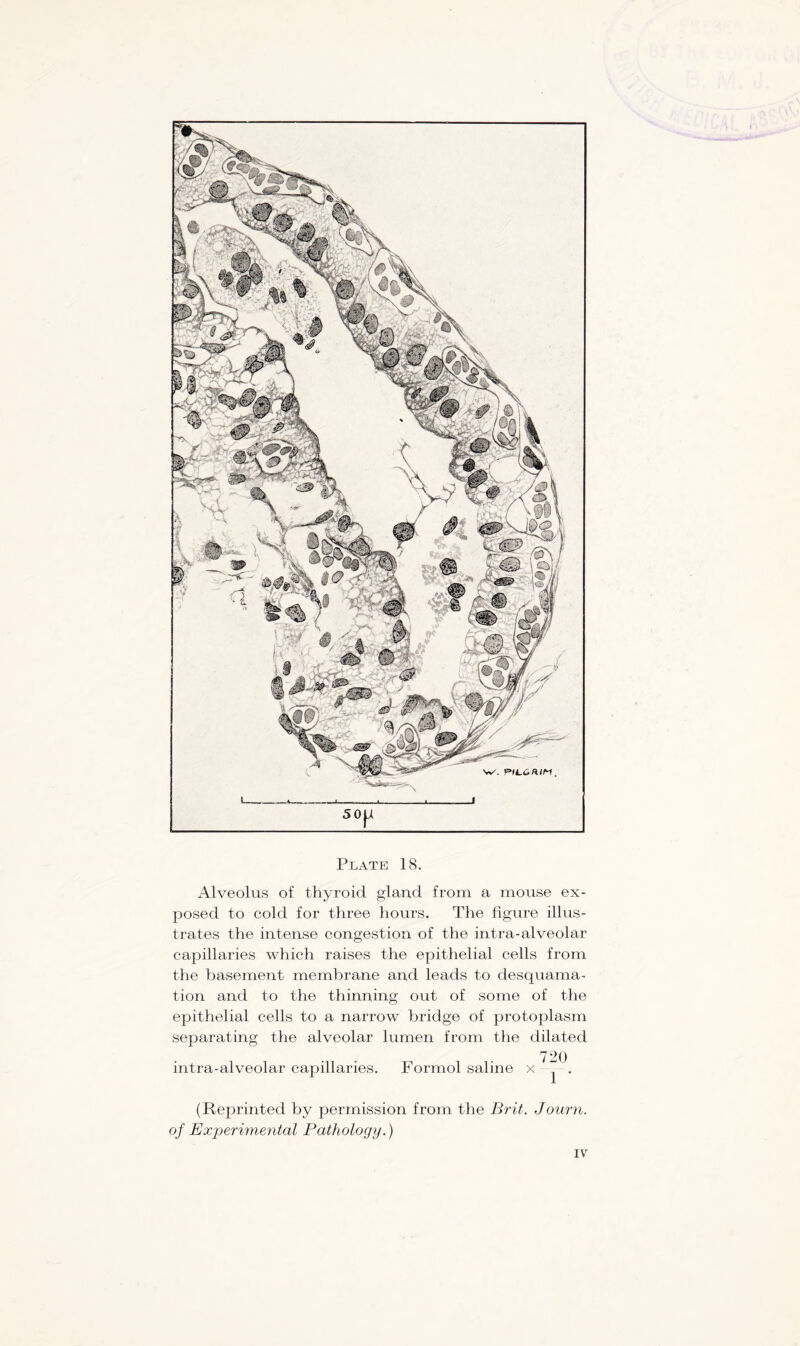 Alveolus of thyroid gland from a mouse ex- posed to cold for three hours. The figure illus- trates the intense congestion of the intra-alveolar capillaries which raises the epithelial cells from the basement membrane and leads to desquama- tion and to the thinning out of some of the epithelial cells to a narrow bridge of protoplasm separating the alveolar lumen from the dilated 720 intra-alveolar capillaries. Formol saline x - . (Reprinted by permission from the Brit. Journ. of Experimental Pathology.)