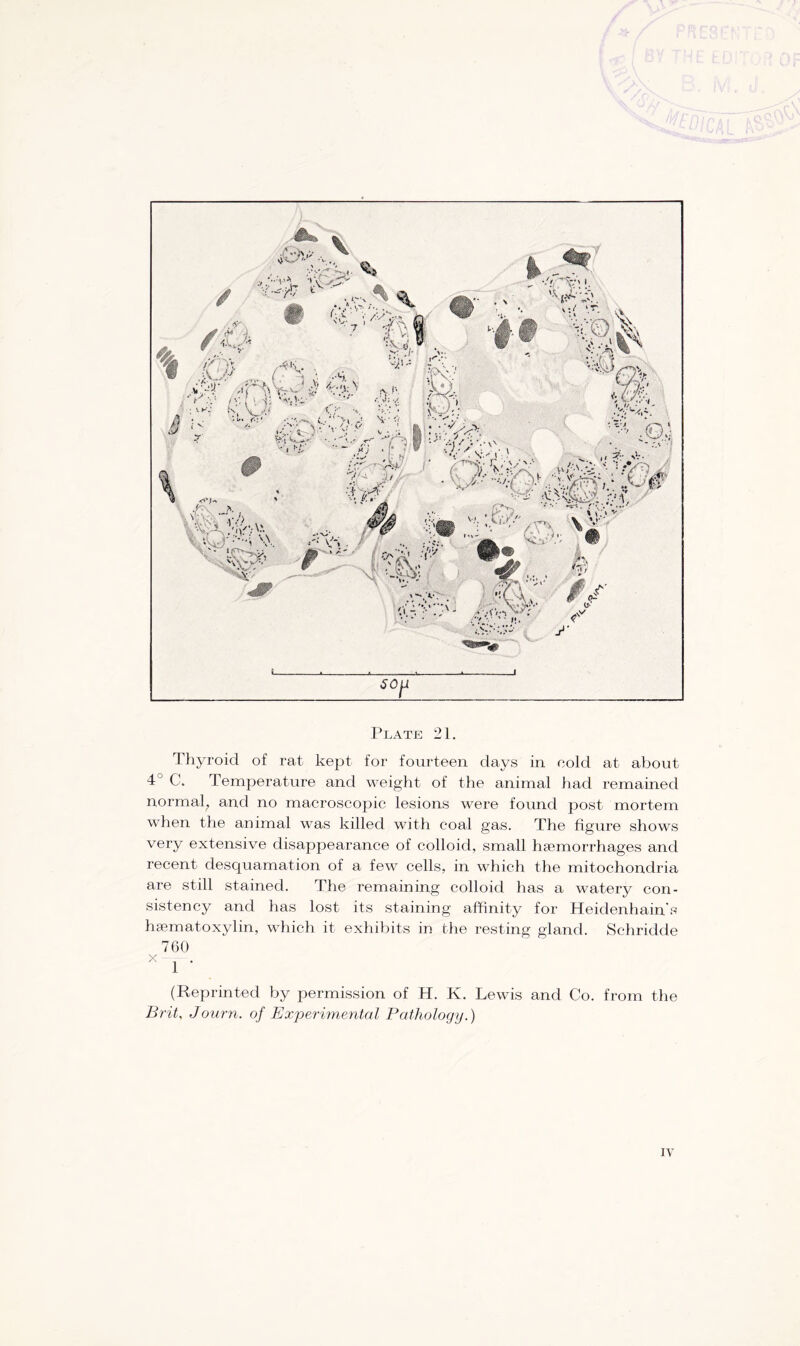 Thyroid of rat kept for fourteen days in cold at about 4 C. Temperature and weight of the animal had remained normal, and no macroscopic lesions were found post mortem when the animal was killed with coal gas. The figure shows very extensive disappearance of colloid, small haemorrhages and recent desquamation of a few cells, in which the mitochondria are still stained. The remaining colloid has a watery con- sistency and has lost its staining affinity for Heidenhain's hsematoxylin, which it exhibits in the resting gland. Schriclde 760 X 1 ‘ (Reprinted by permission of H. K. Lewis and Co. from the Brit, Journ. of Experimental Pathology.)