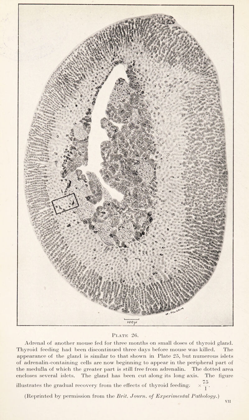 WiH -o o'. S?kH*Vi<5 i *&£&■ **> &,* **<*?* '',0»/i'°o^' *«;■*» °-»<• q oB 0 « «■ . • 0- a. p.1» 4&v v. %*«,; - <? o V«o*, 4&£& , Mi* &xms? *i efo * ** a<* ^ ^ fe'oijr :^ &S?5 ^ « o^wa^S*1 * v- $ *tgO**l'a§ *<*/*■■ , »*■ 'o'* . o *Ww.te<**= i jxf ./jr. esf^a O O ^ OO o 0*«jJS r, ! '• .a««.*|“»t .« <> .TIA^^aMBsL !s&W X,«o90»Cf» o r, <J ° ^iosoo-o A. >« “ -> o Pr, o<i(i O® ' t> o . . o 0 &w*.y'~r y &« J^o»oo»3i :>l'n?o<’^ », A« '. - « v *^,r4 vt o'. „ 0 0 -5 „^o\ > -1 V S’#V 0.»0« »„• Ltf« » rjStf.Vl ; V . '*!%■ oo° /?* o- a * . ~ G a ° a o o s' o .<> .. .« . a u - o il S* *•* » « o®S0On *' * ** ° 0* ^-11L ‘^V ° °A^65> *V ■* %‘’Z .. * -7^1 *« A»‘o« „ » <n0 «0 « c o “ • O.-,^ „W« O 9.° a? BP J0 » jgo ’oc’wrB «®°‘5V £oVo „e °o 2, °o A oo° teY fkc^ »’’■ SM« c/Qfl®0 t, &P-' ^Oi? ^o^bo ^ CptlP' ?'W’C> ■ ■ ■ *r^>^t y< ■ lOOjJ Plate 26. Adrenal of another mouse fed for three months on small doses of thyroid gland. Thyroid feeding had been discontinued three days before mouse was killed. The appearance of the gland is similar to that shown in Plate 25, but numerous islets of adrenalin-containing cells are now beginning to appear in the peripheral part of the medulla of which the greater part is still free from adrenalin. The dotted area encloses several islets. The gland has been cut along its long axis. The figure 75 illustrates the gradual recovery from the effects of thyroid feeding. x --. (Reprinted by permission from the Brit. Journ. of Experimental Pathology.)