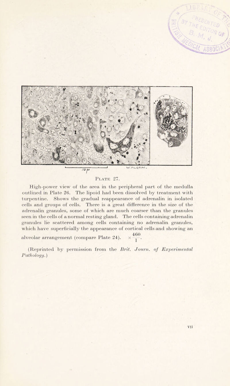 High-power view of the area in the peripheral part of the medulla outlined in Plate 26. The lipoid had been dissolved by treatment with turpentine. Shows the gradual reappearance of adrenalin in isolated cells and groups of cells. There is a great difference in the size of the adrenalin granules, some of which are much coarser than the granules seen in the cells of a normal resting gland. The cells containing adrenalin granules lie scattered among cells containing no adrenalin granules, which have superficially the appearance of cortical cells and showing an alveolar arrangement (compare Plate 24). x (Reprinted by permission from the Brit. Journ. of Exjoerimental Pathology.)
