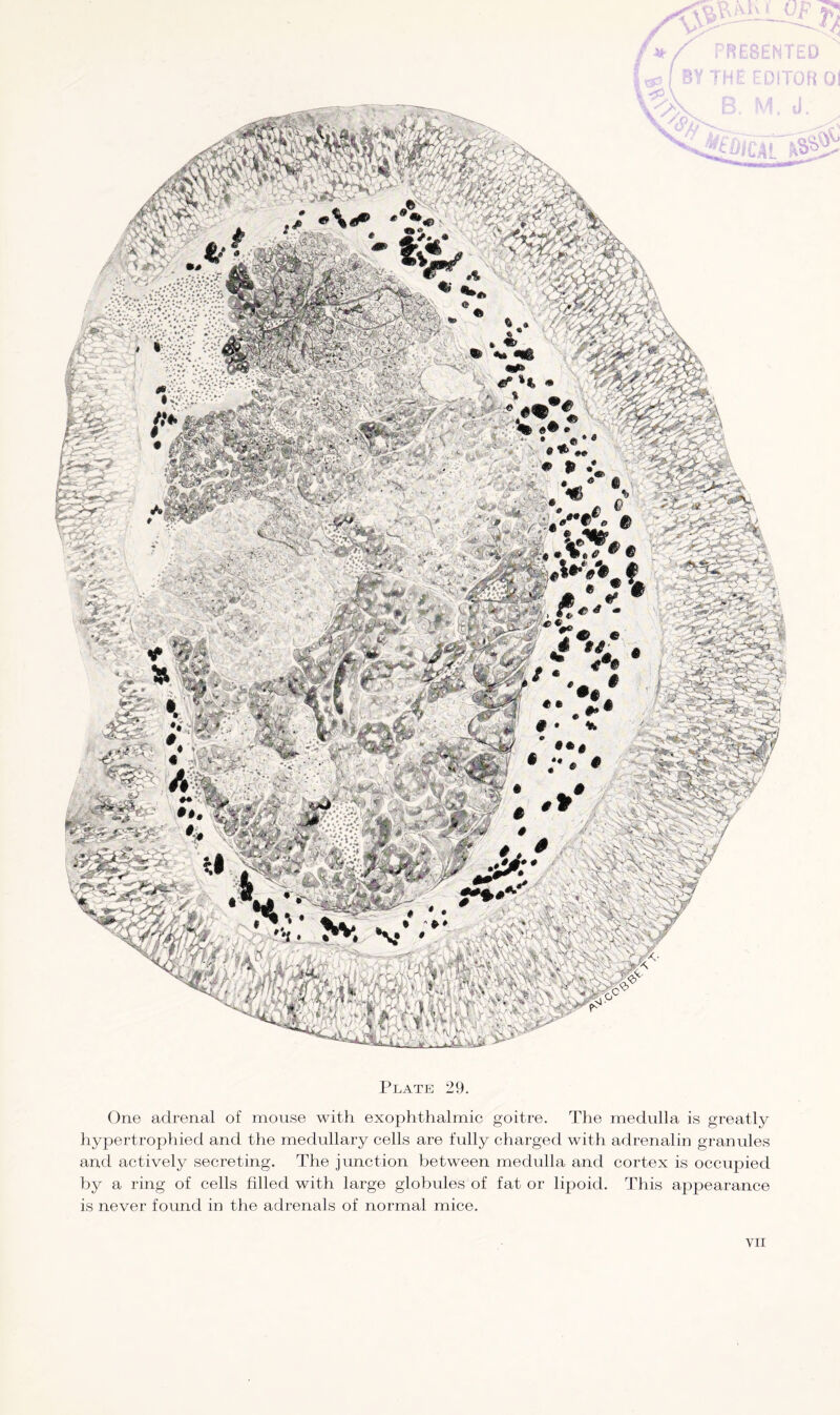 y,;ry- V - '-T‘> 4- : Plate 29. One adrenal of mouse with exophthalmic goitre. The medulla is greatly hypertrophied and the medullary cells are fully charged with adrenalin granules and actively secreting. The junction between medulla and cortex is occupied by a ring of cells filled with large globules of fat or lipoid. This appearance is never found in the adrenals of normal mice.