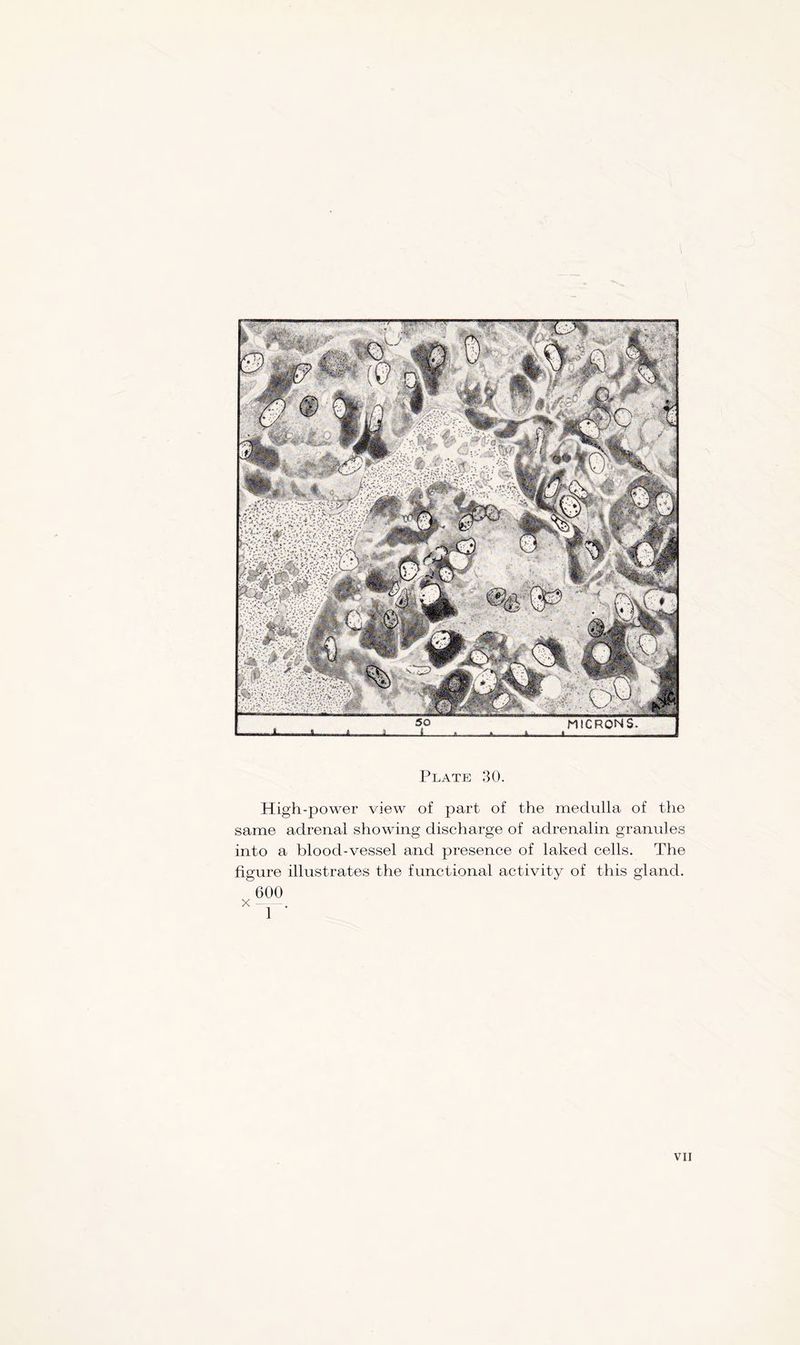 High-power view of part of the medulla of the same adrenal showing discharge of adrenalin granules into a blood-vessel and presence of laked cells. The figure illustrates the functional activity of this gland. 600