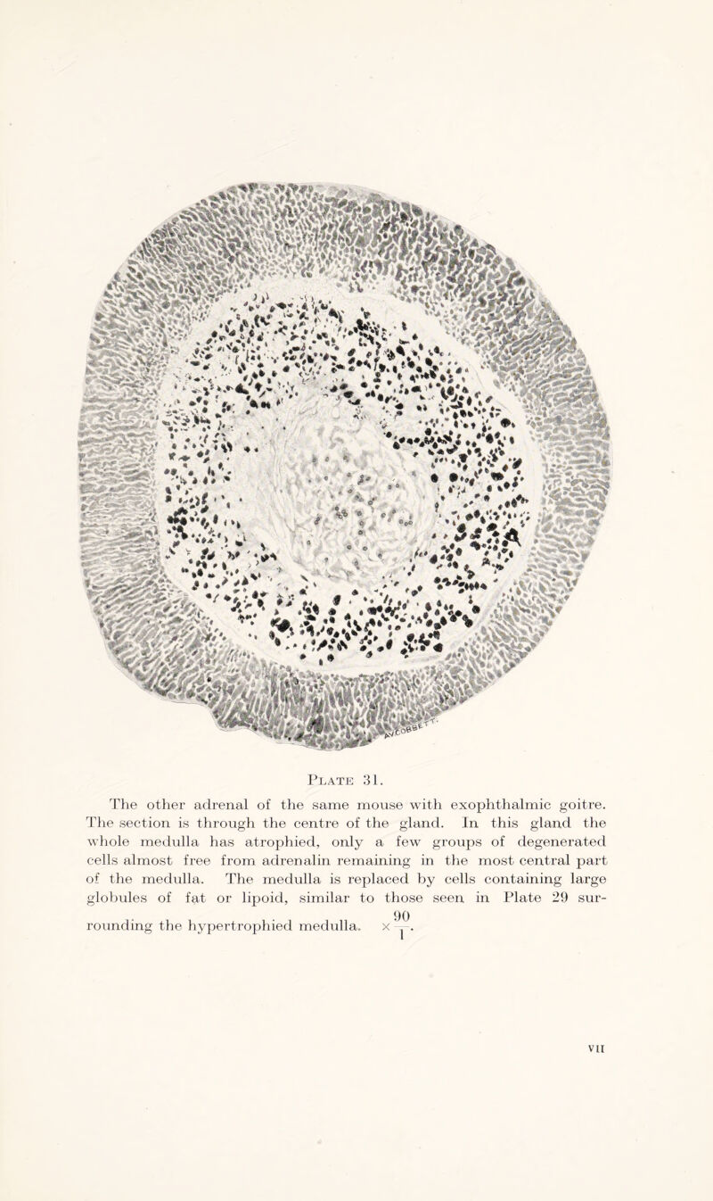 The other adrenal of the same mouse with exophthalmic goitre. The section is through the centre of the gland. In this gland the whole medulla has atrophied, only a few groups of degenerated cells almost free from adrenalin remaining in the most central part of the medulla. The medulla is replaced by cells containing large globules of fat or lipoid, similar to those seen in Plate 29 sur- rounding the hypertrophied medulla.