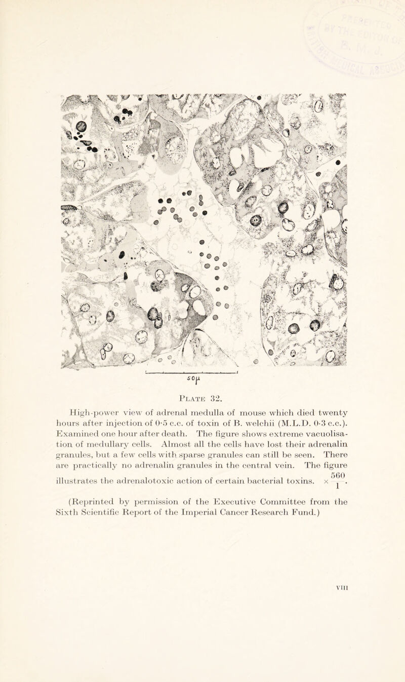 £0 Plate 32. High-power view of adrenal medulla of mouse which died twenty hours after injection of 0-5 c.c. of toxin of B. welchii (M.L.D. 0-3 c.c.). Examined one hour after death. The figure shows extreme vacuolisa- tion of medullary cells. Almost all the cells have lost their adrenalin granules, but a few cells with sparse granules can still be seen. There are practically no adrenalin granules in the central vein. The figure (Reprinted by permission of the Executive Committee from the Sixth Scientific Report of the Imperial Cancer Research Fund.)