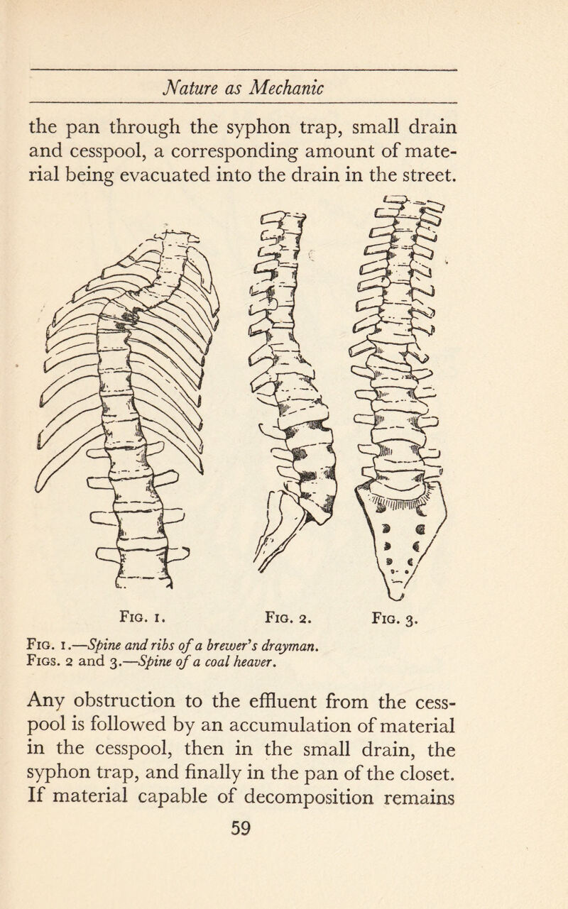 the pan through the syphon trap, small drain and cesspool, a corresponding amount of mate- rial being evacuated into the drain in the street. Fig. i.—Spine and ribs of a brewer's drayman. Figs. 2 and 3.—Spine of a coal heaver. Any obstruction to the effluent from the cess- pool is followed by an accumulation of material in the cesspool, then in the small drain, the syphon trap, and finally in the pan of the closet. If material capable of decomposition remains