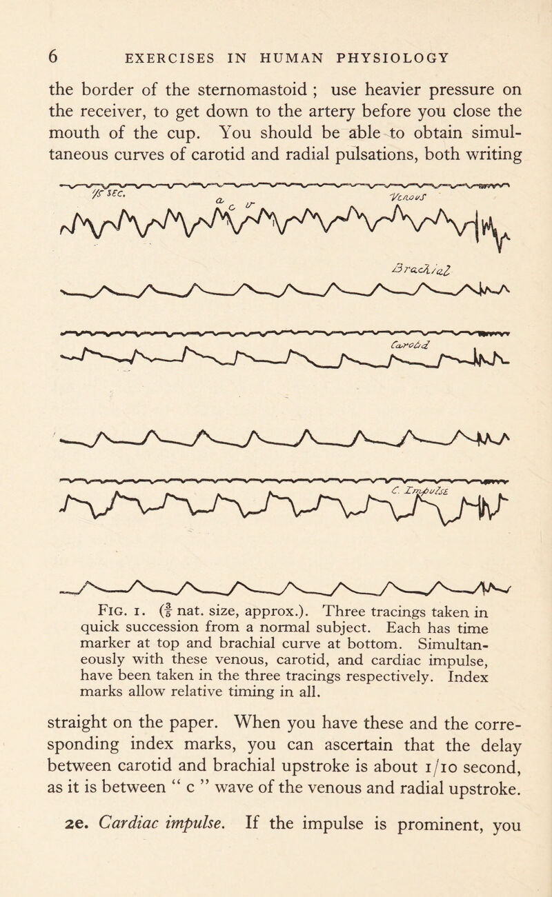 the border of the sternomastoid ; use heavier pressure on the receiver, to get down to the artery before you close the mouth of the cup. You should be able to obtain simul- taneous curves of carotid and radial pulsations, both writing Fig. i. (f nat. size, approx.). Three tracings taken in quick succession from a normal subject. Each has time marker at top and brachial curve at bottom. Simultan- eously with these venous, carotid, and cardiac impulse, have been taken in the three tracings respectively. Index marks allow relative timing in all. straight on the paper. When you have these and the corre- sponding index marks, you can ascertain that the delay between carotid and brachial upstroke is about i/io second, as it is between “ c ” wave of the venous and radial upstroke. 2e. Cardiac impulse. If the impulse is prominent, you