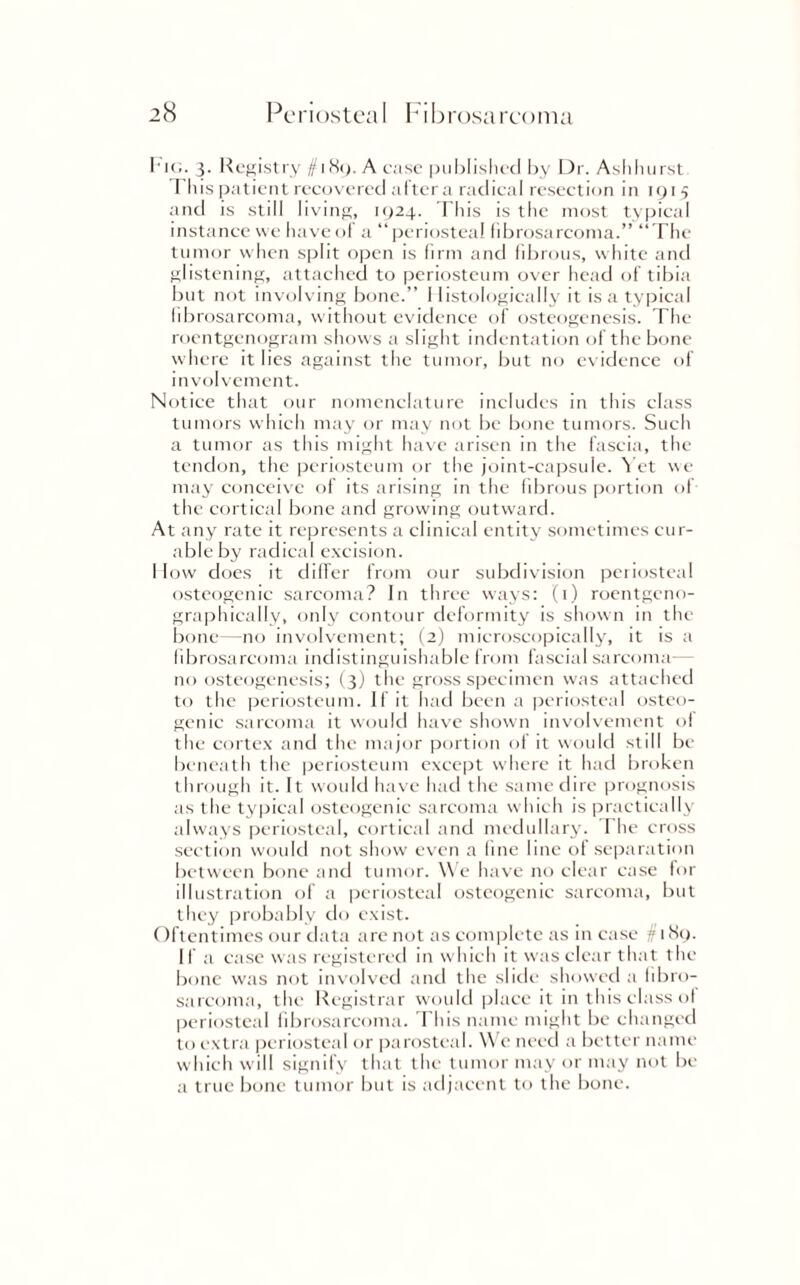 Fig. 3. Registry ^i8y.A case published by Dr. Ashhurst This patient recovered aftera radical resection in 1915 and is still living, 1924. This is the most typical instance we have of a “ periosteal fibrosarcoma.” “The tumor when split open is firm and fibrous, white and glistening, attached to periosteum over head of tibia but not involving bone.” Histologically it is a typical fibrosarcoma, without evidence of osteogenesis. The roentgenogram shows a slight indentation of the bone where it lies against the tumor, but no evidence of involvement. Notice that our nomenclature includes in this class tumors which may or may not be bone tumors. Such a tumor as this might have arisen in the fascia, the tendon, the periosteum or the joint-capsule. Yet we may conceive of its arising in the fibrous portion of the cortical bone and growing outward. At any rate it represents a clinical entity sometimes cur¬ able by radical excision. I low does it differ from our subdivision periosteal osteogenic sarcoma? In three ways: (1) roentgeno- graphically, only contour deformity is shown in the bone—no involvement; (2) microscopically, it is a fibrosarcoma indistinguishable from fascial sarcoma— no osteogenesis; (3) the gross specimen was attached to the periosteum. If it had been a periosteal osteo¬ genic sarcoma it would have shown involvement o! the cortex and the major portion of it would still be beneath the periosteum except where it had broken through it. It would have had the same dire prognosis as the typical osteogenic sarcoma which is practically always periosteal, cortical and medullary. The cross section would not show even a fine line of separation between bone and tumor. We have no clear case for illustration of a periosteal osteogenic sarcoma, but they probably do exist. Oftentimes our data are not as complete as in case § 1 Sy. If a case was registered in which it was clear that the bone was not involved and the slide showed a fibro¬ sarcoma, the Registrar would place it in this class ot periosteal fibrosarcoma. This name might be changed to extra periosteal or parosteal. We need a better name which w ill signify that the tumor may or may not be a true bone tumor but is adjacent to the bone.