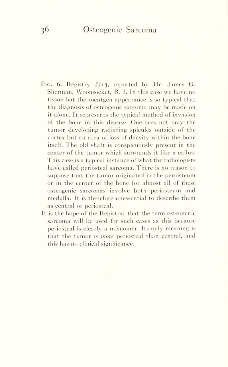 Fig. 6. Registry #513, reported by Dr. James G. Sherman, Woonsocket, R. I. In this case we have no tissue but the roentgen appearance is so typical that the diagnosis of osteogenic sarcoma may be made on it alone. It represents the typical method of invasion of the bone in this disease. One sees not only the tumor developing radiating spicules outside of the cortex but an area of loss of density within the bone itself. The old shaft is conspicuously present in the center of the tumor which surrounds it like a callus. This case is a typical instance of what the radiologists have called periosteal sarcoma. There is no reason to suppose that the tumor originated in the periosteum or in the center of the bone for almost all of these osteogenic sarcomas involve both periosteum and medulla. It is therefore unessential to describe them as central or periosteal. It is the hope of the Registrar that the term osteogenic sarcoma will be used for such cases as this because periosteal is clearly a misnomer. Its only meaning is that the tumor is more periostea! than central, and this has no clinical significance.