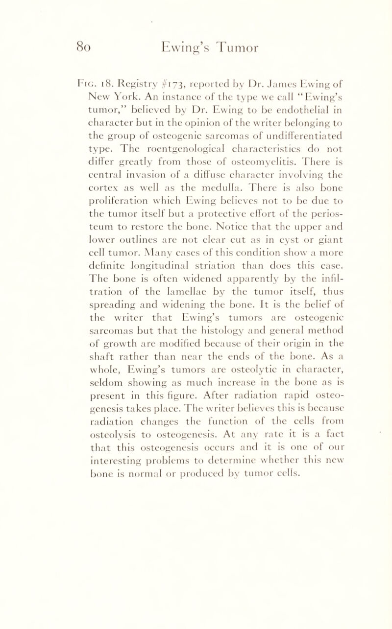 Fig. 18. Registry #173, reported by Dr. James Ewing of New York. An instance of the type we call “Ewing’s tumor,” believed by Dr. Ewing to be endothelial in character but in the opinion of the writer belonging to the group of osteogenic sarcomas of undifferentiated type. The roentgenological characteristics do not differ greatly from those of osteomyelitis. There is central invasion of a diffuse character involving the cortex as well as the medulla. Tiiere is also bone proliferation which Ewing believes not to be due to the tumor itself but a protective effort of the perios¬ teum to restore the bone. Notice that the upper and lower outlines are not clear cut as in cyst or giant cell tumor. Many cases of this condition show a more definite longitudinal striation than does this case. The bone is often widened apparently by the infil¬ tration of the lamellae by the tumor itself, thus spreading and widening the bone. It is the belief of the writer that Ewing’s tumors are osteogenic sarcomas but that the histology and general method of growth are modified because of their origin in the shaft rather than near the ends of the bone. As a whole, Ewing’s tumors are osteolytic in character, seldom showing as much increase in the bone as is present in this figure. After radiation rapid osteo¬ genesis takes place. The writer believes this is because radiation changes the function of the cells Irom osteolysis to osteogenesis. At any rate it is a fact that this osteogenesis occurs and it is one of out- interesting problems to determine whether this new bone is normal or produced by tumor cells.