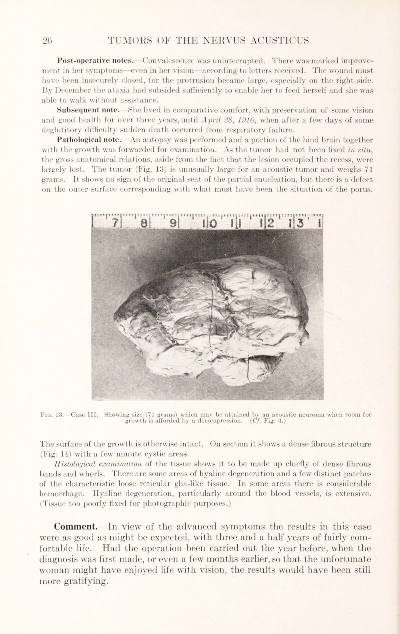 Post-operative notes.—Convalescence was uninterrupted. There was marked improve¬ ment in her symptoms—even in her vision—according to letters received. The wound must have been insecurely closed, for the protrusion became large, especially on the right side. By December the ataxia had subsided sufficiently to enable her to feed herself and she was able to walk without assistance. Subsequent note.—She lived in comparative comfort, with preservation of some vision and good health for over three years, until April 28, 1910, when after a few days of some deglutitory difficulty sudden death occurred from respiratory failure. Pathological note.—An autopsy was performed and a portion of the hind brain together with the growth was forwarded for examination. As the tumor had not been fixed in situ, the gross anatomical relations, aside from the fact that the lesion occupied the recess, were largely lost. The tumor (Fig. 13) is unusually large for an acoustic tumor and weighs 71 grams. It shows no sign of the original seat of the partial enucleation, but there is a defect on the outer surface corresponding with what must have been the situation of the porus. Fig. 13.—Case III. Showing size (71 grams) which may be attained by an acoustic neuroma when room for growth is afforded by a decompression. (Cf. Fig. 4.) The surface of the growth is otherwise intact. On section it shows a dense fibrous structure (Fig. 14) with a few minute cystic areas. Histological examination of the tissue shows it to be made up chiefly of dense fibrous bands and whorls. There are some areas of hyaline degeneration and a few distinct patches of the characteristic loose reticular glia-like tissue. In some areas there is considerable hemorrhage. Hyaline degeneration, particularly around the blood vessels, is extensive. (Tissue too poorly fixed for photographic purposes.) Comment.—In view of the advanced symptoms the results in this case were as good as might be expected, with three and a half years of fairly com¬ fortable life. Had the operation been carried out the year before, when the diagnosis was first made, or even a few months earlier, so that the unfortunate woman might have enjoyed life with vision, the results would have been still more gratifying.