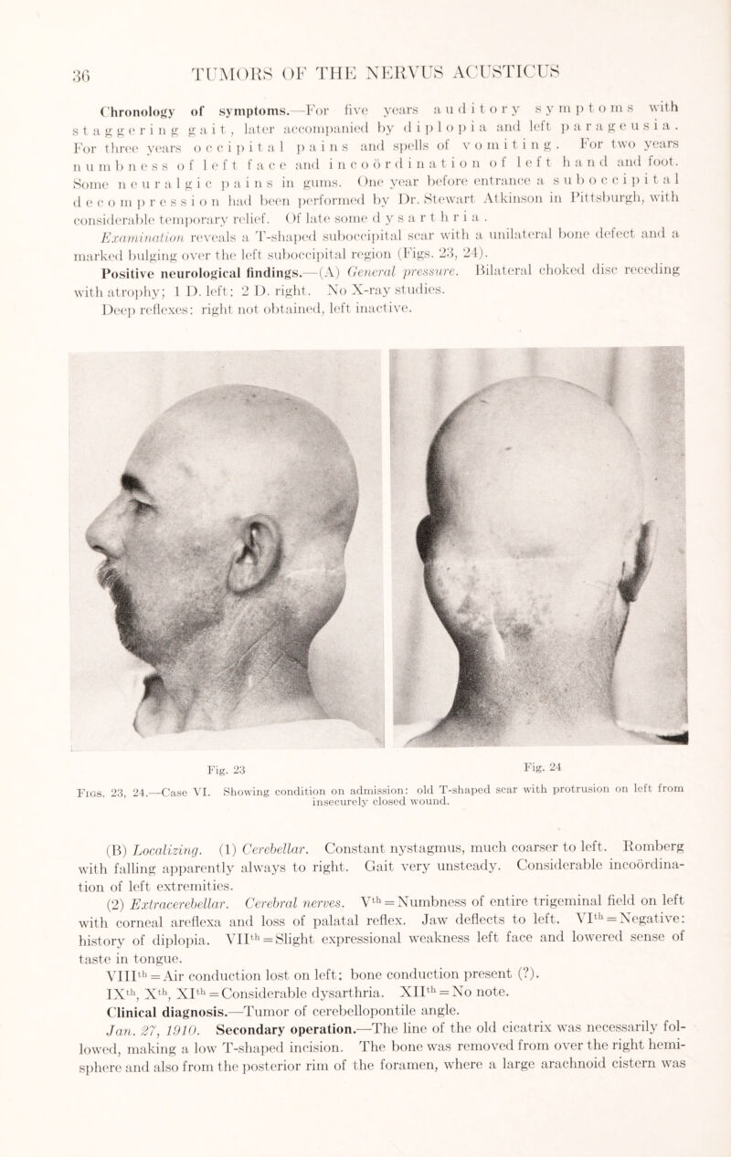 Chronology of symptoms.—For five years auditory s y m p t o m s with staggering gait, later accompanied by diplopia and left p a i a g e u s i a . For three years occipital pains and spells of vomiting. For two yeais n u m b n e s s of left face and incoordination o 1 left hand and foot. Some neuralgic pains in gums. One year before entrance a suboccipital decompression had been performed by Dr. Stewart Atkinson in Pittsburgh, with considerable temporary relief. Of late some d y s a r t h r i a . Examination reveals a T-shaped suboccipital scar with a unilateral bone defect and a marked bulging over the left suboccipital region (Figs. 23, 24). Positive neurological findings.—(A) General pressure. Bilateral choked disc receding with atrophy; 1 D. left: 2 D. right. No X-ray studies. Deep reflexes: right not obtained, left inactive. Fig. 23 Fig- 24 Figs. 23, 24.—Case VI. Showing condition on admission: old T-shaped scar with protrusion on left from insecurely closed wound. (B) Localizing. (1) Cerebellar. Constant nystagmus, much coarser to left, Romberg with falling apparently always to right. Gait very unsteady. Considerable incoordina¬ tion of left extremities. (2) Extracerebellar. Cerebral nerves. Vth = Numbness of entire trigeminal field on left with corneal areflexa and loss of palatal reflex. Jaw deflects to left. VIth = Negative: history of diplopia. VIIth = Slight expressional weakness left face and lowered sense of taste in tongue. VIIIth = Air conduction lost on left: bone conduction present (?). IXth, Xth, XIth = Considerable dysarthria. XIIth = No note. Clinical diagnosis.—Tumor of cerebellopontile angle. Jan. 27, 1910. Secondary operation.—The line of the old cicatrix was necessarily fol¬ lowed, making a low T-shaped incision. The bone was removed from over the right hemi¬ sphere and also from the posterior rim of the foramen, where a large arachnoid cistern was