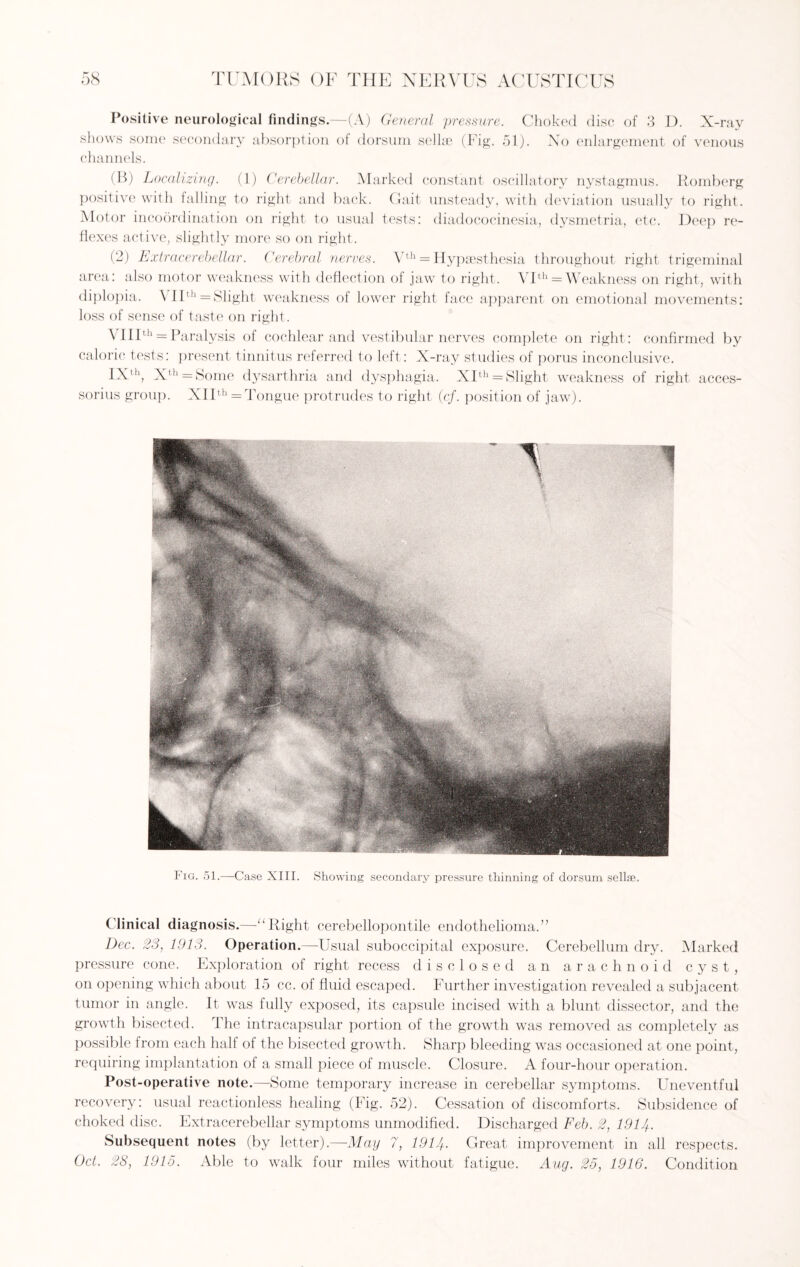 Positive neurological findings.—(A) General pressure. Choked disc of 3 D. X-ray shows some secondary absorption of dorsum sellae (Fig. 51). No enlargement of venous channels. (B) Localizing. (1) Cerebellar. Marked constant oscillatory nystagmus. Romberg positive with falling to right and back. Gait unsteady, with deviation usually to right. Motor incoordination on right to usual tests: diadococinesia, dysmetria, etc. Deep re¬ flexes active, slightly more so on right. (2) Extracerebellar. Cerebral nerves. Vth = Hypaesthesia throughout right trigeminal area: also motor weakness with deflection of jaw to right. VIth = Weakness on right, with diplopia. VIIth = Slight weakness of lower right face apparent on emotional movements: loss of sense of taste on right. \ IIIth = Paralysis of cochlear and vestibular nerves complete on right: confirmed by caloric tests: present tinnitus referred to left: X-ray studies of porus inconclusive. IXth, Xth = Some dysarthria and dysphagia. XIth = Slight weakness of right acces¬ sorius group. XIIth = Tongue protrudes to right (cf. position of jaw). Fig. 51.—Case XIII. Showing secondary pressure thinning of dorsum sellae. Clinical diagnosis.—“Right cerebellopontile endothelioma.” Dec. 23, 1913. Operation.—Usual suboccipital exposure. Cerebellum dry. Marked pressure cone. Exploration of right recess disclosed an arachnoid cyst, on opening which about 15 cc. of fluid escaped. Further investigation revealed a subjacent tumor in angle. It was fully exposed, its capsule incised with a blunt dissector, and the growth bisected. The intracapsular portion of the growth was removed as completely as possible from each halt of the bisected growth. Sharp bleeding was occasioned at one point, requiring implantation of a small piece of muscle. Closure. A four-hour operation. Post-operative note.—-Some temporary increase in cerebellar symptoms. Uneventful recovery: usual reactionless healing (Fig. 52). Cessation of discomforts. Subsidence of choked disc. Extracerebellar symptoms unmodified. Discharged Feb. 2, 1914-. Subsequent notes Oct. 28, 1915. Able (by letter).—May to walk four 7, 191 A. Great miles without fatigue. improvement in all respects. Aug. 25, 1916. Condition