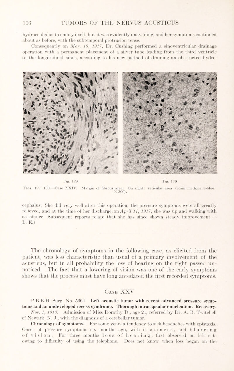 hydrocephalus to empty itself, but it was evidently unavailing, and her symptoms continued about as before, with the subtemporal protrusion tense. Consequently on Mar. 19, 1917, Dr. Cushing performed a sinoventricular drainage operation with a permanent placement of a silver tube leading from the third ventricle to the longitudinal sinus, according to his new method of draining an obstructed hydro- Fig. 129 Fig. 130 Figs. 129, 130.—-Case XXIV. Margin of fibrous area. On right: reticular area (eosin methylene-blue: X 300). cephalus. She did very well after this operation, the pressure symptoms were all greatly relieved, and at the time of her discharge, on April 11, 1917, she was up and walking with assistance. Subsequent reports relate that she has since shown steady improvement.—- L. E.) The chronology of symptoms in the following case, as elicited from the patient, was less characteristic than usual of a primary involvement of the acusticus, but in all probability the loss of hearing on the right passed un¬ noticed. The fact that a lowering of vision was one of the early symptoms shows that the process must have long antedated the first recorded symptoms. Case XXV P.B.B.H. Surg. No. 5664. Left acoustic tumor with recent advanced pressure symp¬ toms and an undeveloped recess syndrome. Thorough intracapsular enucleation. Recovery. Nov. 1, 1916. Admission of Miss Dorothy D., age 21, referred by Dr. A. B. Twitchell of Newark, N. J., with the diagnosis of a cerebellar tumor. Chronology of symptoms.—For some years a tendency to sick headaches with epistaxis. Onset of pressure symptoms six months ago, with dizziness, and b 1 u r ring of vision. For three months loss of hearing, first observed on left side owing to difficulty of using the telephone. Does not know when loss began on the