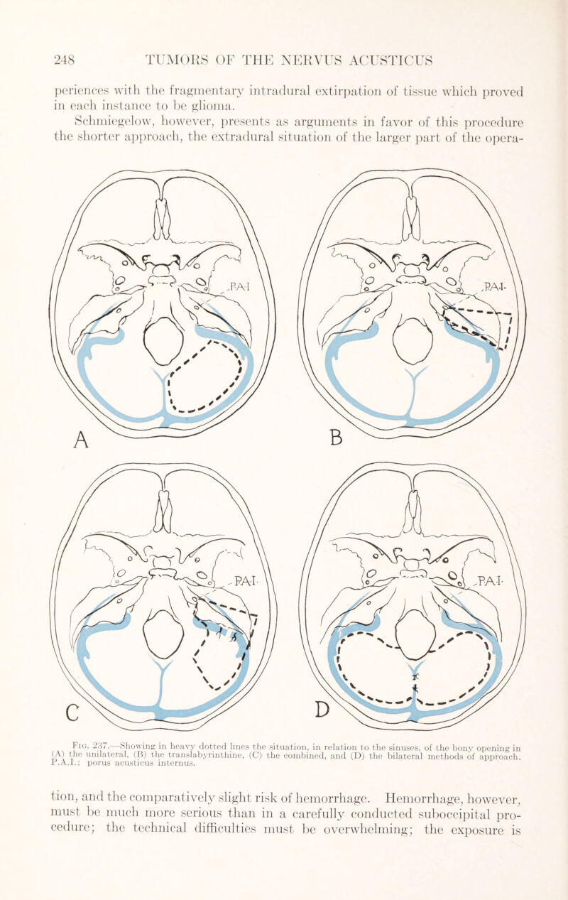 periences with the fragmentary intradural extirpation of tissue which proved in each instance to be glioma. Schmiegelow, however, presents as arguments in favor of this procedure the shorter approach, the extradural situation of the larger part of the opera- Fig. 237. Showing in heavy dotted lines the situation, in relation to the sinuses, of the bony opening in fib unilateral, (B) the translabyrinthine, (C) the combined, and (D) the bilateral methods of approach. P.A.I.: porus acusticus internus. tion, and the comparatively slight risk of hemorrhage. Hemorrhage, however, must be much more serious than in a carefully conducted suboccipital pro¬ cedure; the technical difficulties must be overwhelming; the exposure is