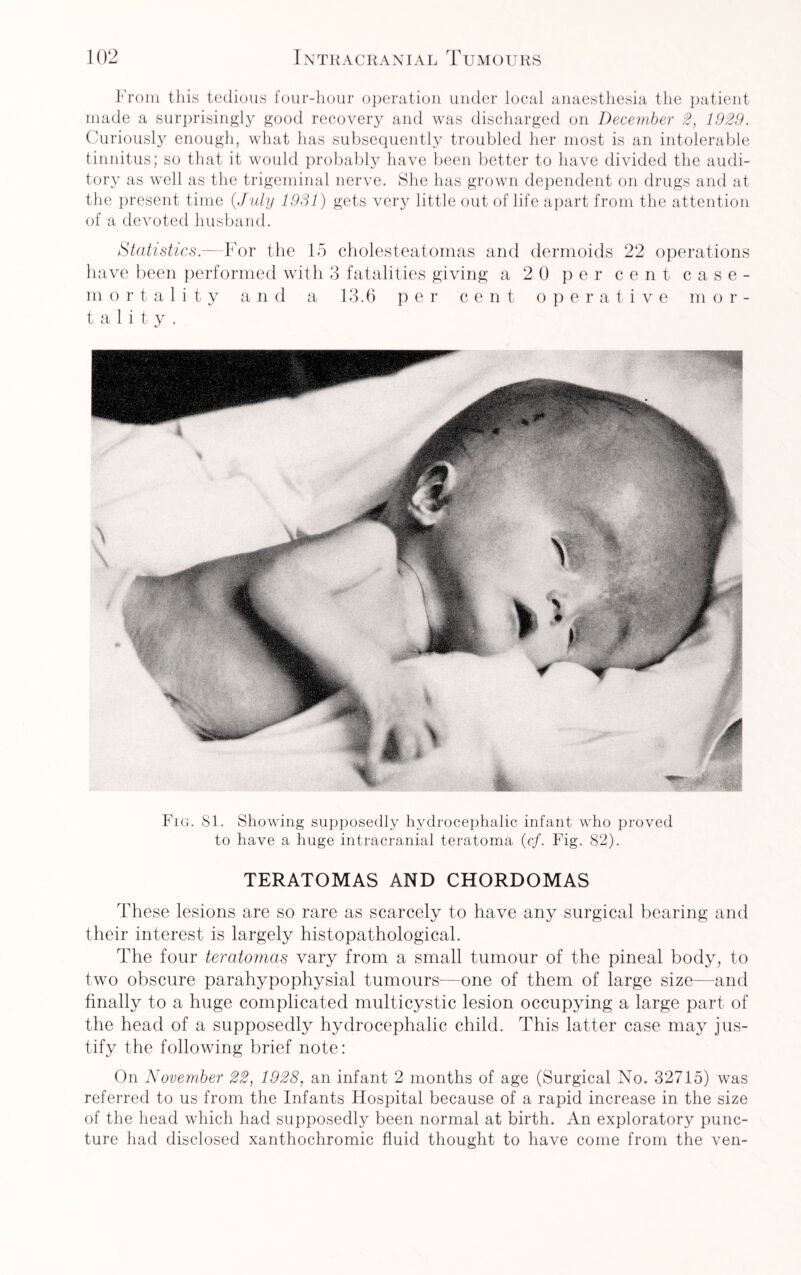 From this tedious four-hour operation under local anaesthesia the patient made a surprisingly good recovery and was discharged on December 2, 1929. Curiously enough, what has subsequently troubled her most is an intolerable tinnitus; so that it would probably have been better to have divided the audi¬ tory as well as the trigeminal nerve. She has grown dependent on drugs and at the present time (July 1931) gets very little out of life apart from the attention of a devoted husband. Statistics.—For the 15 cholesteatomas and dermoids 22 operations have been performed with 3 fatalities giving a 20 per cent case- mortality and a 13.6 per cent operative m o r - t a 1 i t y . Fig. 81. Showing supposedly hydrocephalic infant who proved to have a huge intracranial teratoma (cf. Fig. 82). TERATOMAS AND CHORDOMAS These lesions are so rare as scarcely to have any surgical bearing and their interest is largely histopathological. The four teratomas vary from a small tumour of the pineal body, to two obscure parahypophysial tumours—one of them of large size—and finally to a huge complicated multicystic lesion occupying a large part of the head of a supposedly hydrocephalic child. This latter case may jus¬ tify the following brief note: On November 22, 1928, an infant 2 months of age (Surgical No. 32715) was referred to us from the Infants Hospital because of a rapid increase in the size of the head which had supposedly been normal at birth. An exploratory punc¬ ture had disclosed xanthochromic fluid thought to have come from the ven-