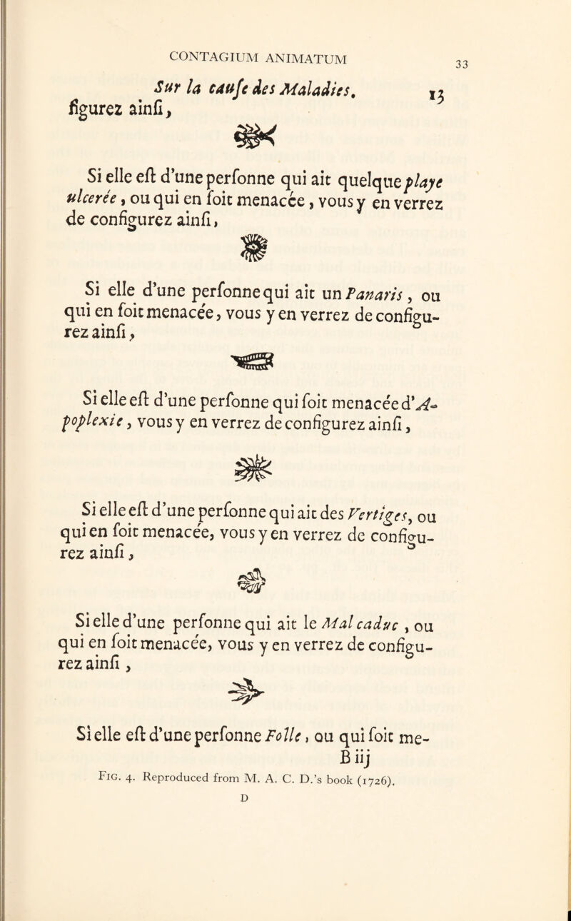 33 Sur la caufe dts Maladies. figurez ainfi. Si elle eft d’une perfonne qui ait quelqueplaye ulceree , ou qui en foit menacce > vous y en verrez de configurez ainft, Si elle d’une perfonne qui ait un Panaris, ou qui en foit menace'e, vous y en verrez de configu- rez ainfi, b ^trnnf' Si elle eft d’ une perfonne qui foit menaceed’^- foplexic, vousy en verrez de configurez ainfi. Si elle eft d’une perfonne qui ait des Vertices, 0u qui en foit menace'e, vous y en verrez de conffou- rez ainfi, a Si elle d’une perfonne qui qui en foit menace'e, vous y rez ainfi , ait le Mai caduc , ou en verrez de configu- Si elle eft d’une perfonne Folk, ou qui foit me- Biij Fig. 4. Reproduced from M. A. C. D.’s book (1726). D