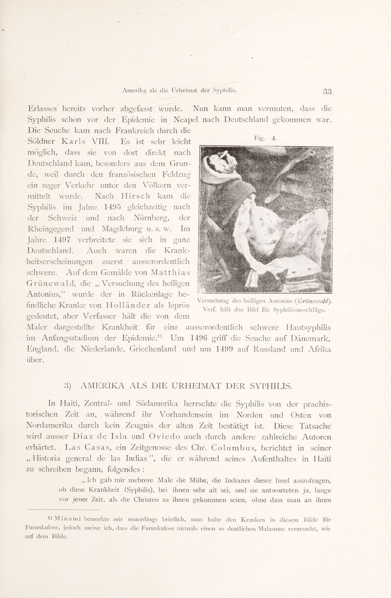 -JO der nach Rheingegend Magdeburg Nürnberg, u s. w. der Im ganz Fig. Erlasses bereits vorher abgefasst wurde. Nun kann man vermuten, dass die Syphilis schon vor der Epidemie in Neapel nach Deutschland gekommen war. Die Seuche kam nach Frankreich durch die Söldner Karls VIII. Es ist sehr leicht möglich, dass sie von dort direkt nach Deutschland kam, besonders aus dem Grun¬ de, weil durch den französischen Feldzug ein reger Verkehr unter den Völkern ver¬ mittelt wurde. Nach Hirsch kam die Syphilis im Jahre 1495 erleichzeitisr nach Schweiz und und Jahre 1497 verbreitete sie sich in Deutschland. Auch waren die Krank¬ heitserscheinungen zuerst ausserordentlich schwere. Auf dem Gemälde von Matthias G r ü n e w a 1 d, die ,, Versuchung des heiligen Antonius,” wurde der in Rückenlage be¬ findliche Kranke von Holländer als leprös gedeutet, aber Verfasser hält die von dem Maler dargestellte Krankheit für eine ausserordentlich schwere Hautsyphilis im Anfangsstadium der Epidemie.0 Um 1496 griff die Seuche auf Dänemark, England, die Niederlande, Griechenland und um 1499 auf Russland und Afrika über. Versuchung des heiligen Antonius (Grünewald). Ve-rf. hält das Bild für Syphilisausschläge. 3) AMERIKA ALS DIE URHEIMAT DER SYPHILIS. In Haiti, Zentral- und Südamerika herrschte die Syphilis von der praehis- torischen Zeit an, während ihr Vorhandensein im Norden und Osten von Nordamerika durch kein Zeugnis der alten Zeit bestätigt ist. Diese Tatsache wird ausser Diaz de Isla und Oviedo auch durch andere zahlreiche Autoren erhärtet. Las Casas, ein Zeitgenosse des Chr. Columbus, berichtet in seiner ,, Historia general de las Indias ”, die er während seines Aufenthaltes in Haiti zu schreiben begann, folgendes : ,, Ich gab mir mehrere Male die Mühe, die Indianer dieser Insel auszufragen, ob diese Krankheit (Syphilis), bei ihnen sehr alt sei, und sie antworteten ja, lange vor jener Zeit, als die Christen zu ihnen gekommen seien, ohne dass man an ihren ° Minami bemerkte mir neuerdings brieflich, man halte den Kranken in diesem Bilde für Furunkulose, jedoch meine ich, dass die Furunkulose niemals einen so deutlichen Malasmus verursacht, wie auf dem Bilde.