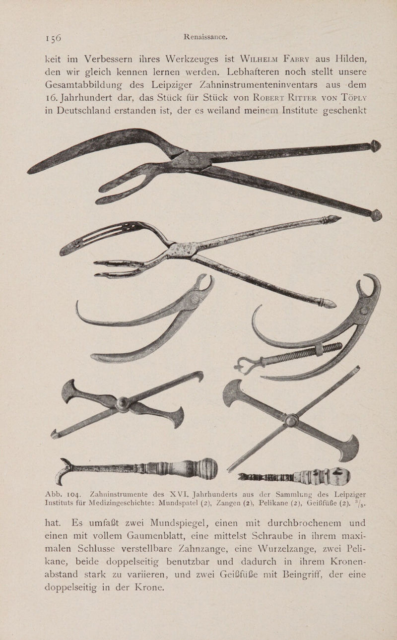 keit im Verbessern ihres Werkzeuges ist Wilhelm Fabry aus Hilden, den wir gleich kennen lernen werden. Lebhafteren noch stellt unsere Gesamtabbildung des Leipziger Zahninstrumenteninventars aus dem 16. Jahrhundert dar, das Stück für Stück von Robert Ritter von Töply in Deutschland erstanden ist, der es weiland meinem Institute geschenkt Abb. 104. Zahninstrumente des XVI. Jahrhunderts aus der Sammlung des Leipziger Instituts für Medizingeschichte: Mundspatel (2), Zangen (2), Pelikane (2), Geißfüße (2). 3/5. hat. Es umfaßt zwei Mundspiegel, einen mit durchbrochenem und einen mit vollem Gaumenblatt, eine mittelst Schraube in ihrem maxi¬ malen Schlüsse verstellbare Zahnzange, eine Wurzelzange, zwei Peli¬ kane, beide doppelseitig benutzbar und dadurch in ihrem Kronen¬ abstand stark zu variieren, und zwei Geißfüße mit Beingriff, der eine doppelseitig in der Krone.